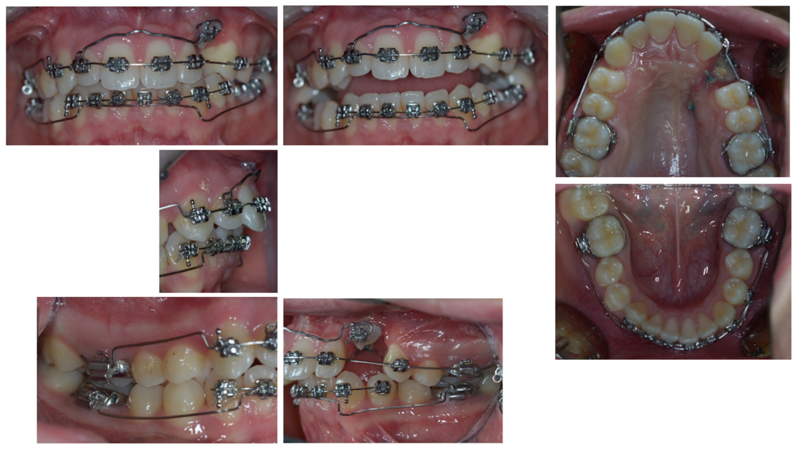 Dentistry 11 00278 g004