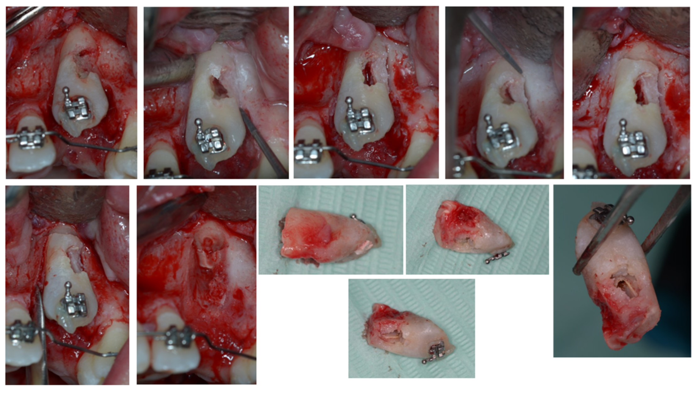 Dentistry 11 00278 g006