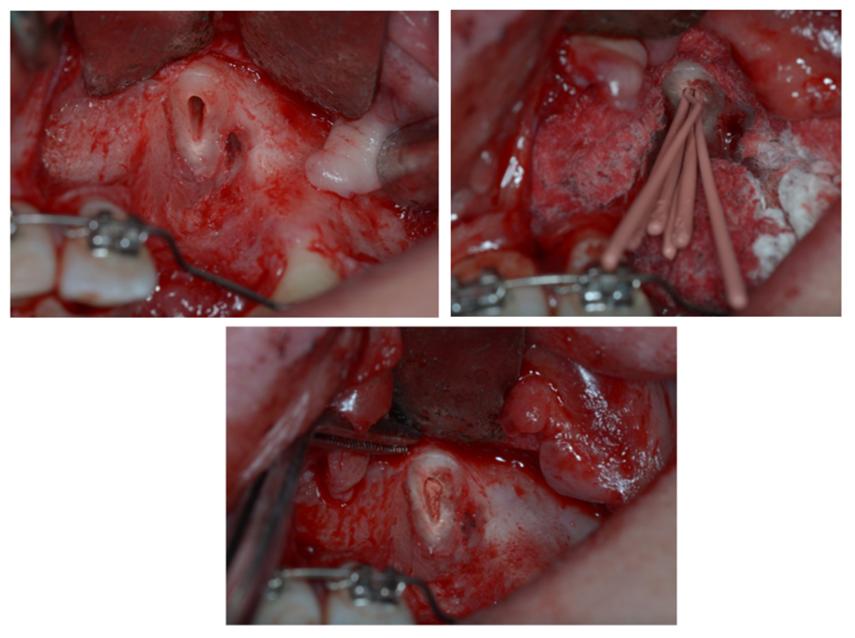 Dentistry 11 00278 g007