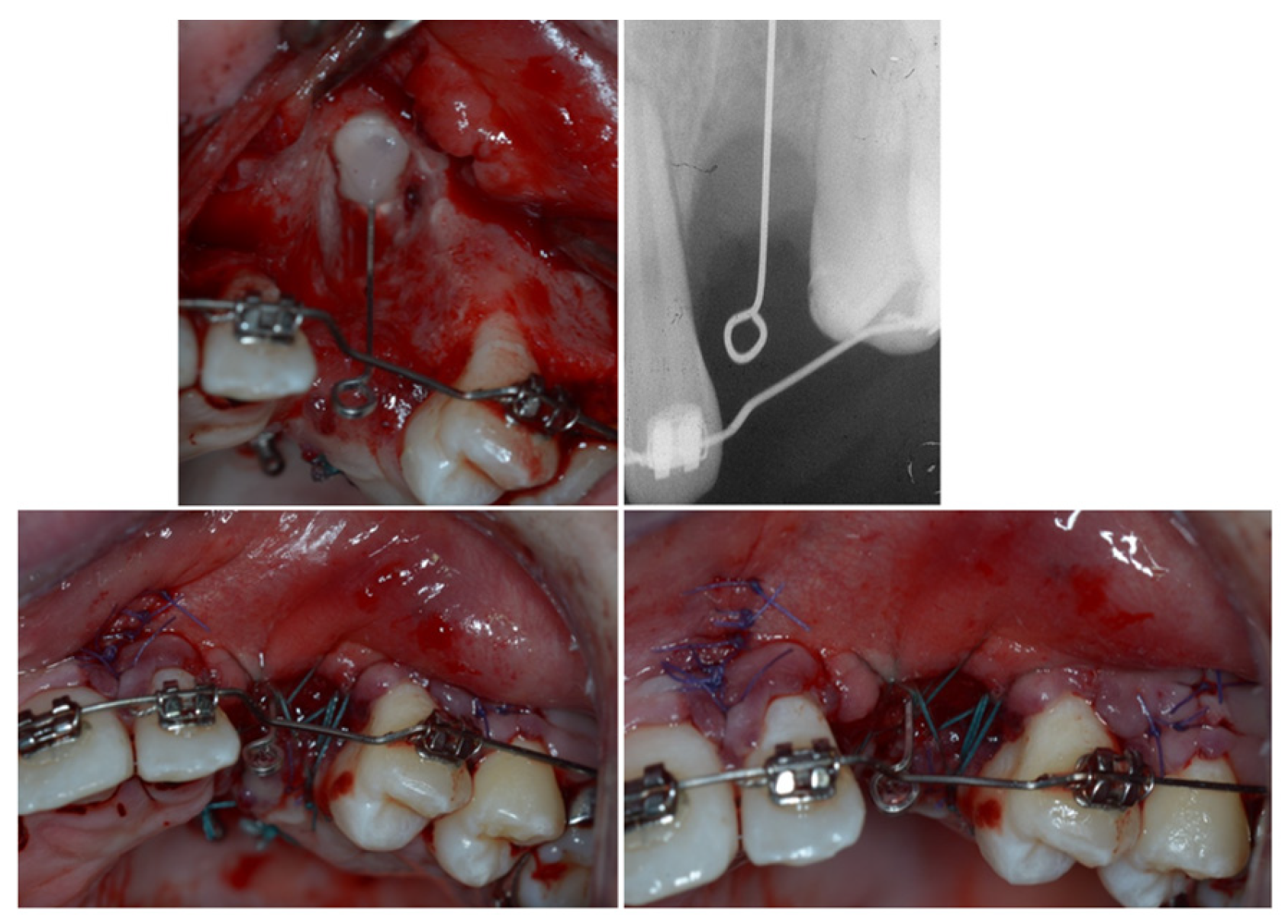 Dentistry 11 00278 g008