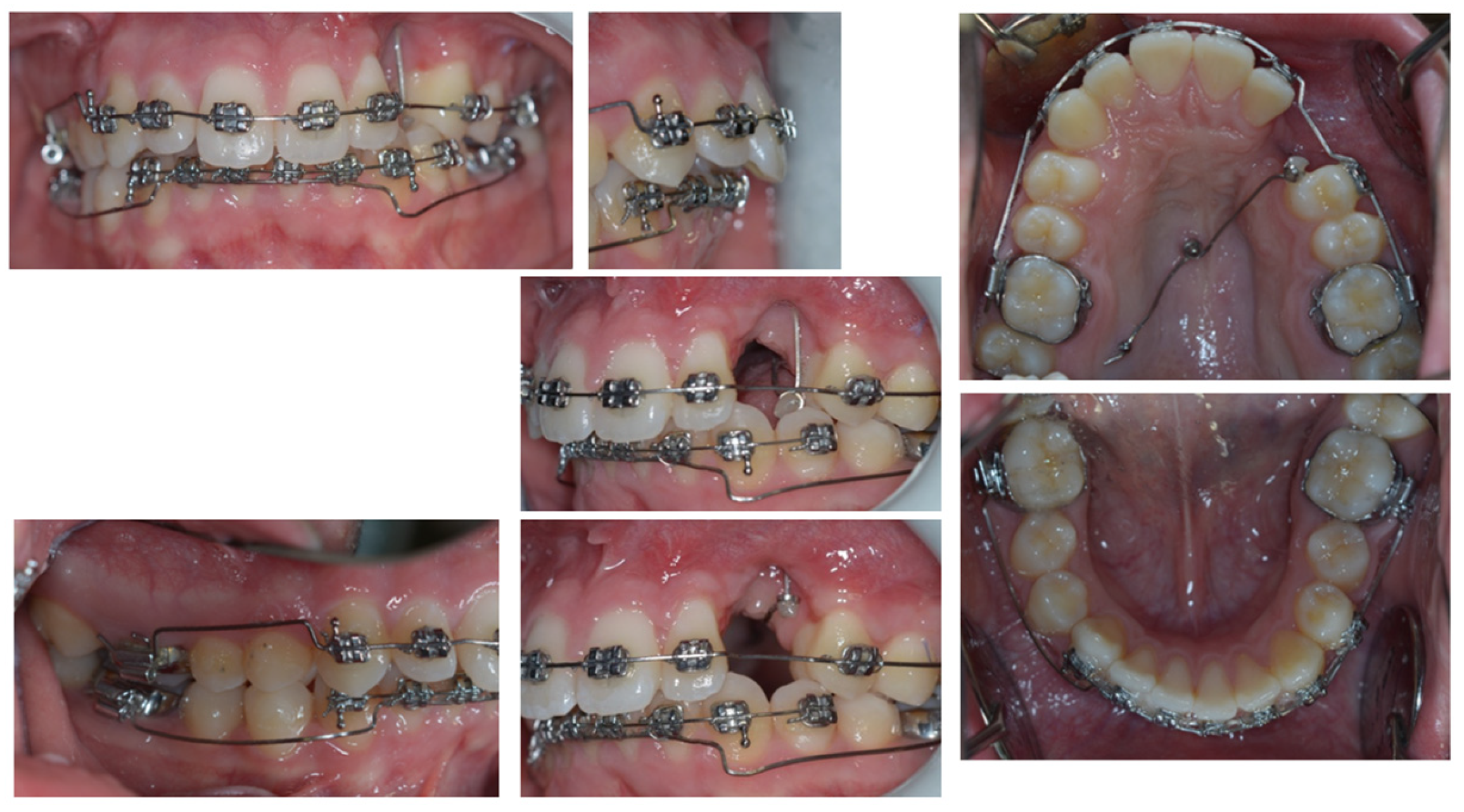 Dentistry 11 00278 g009