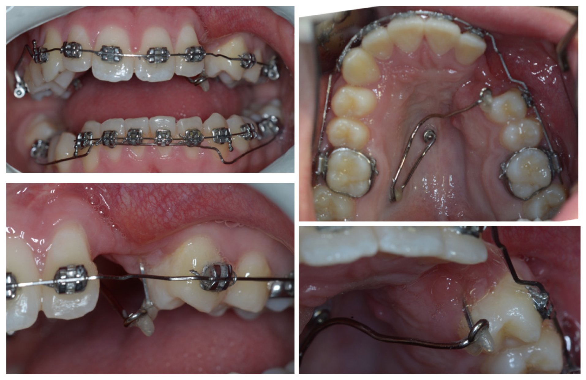 Dentistry 11 00278 g010