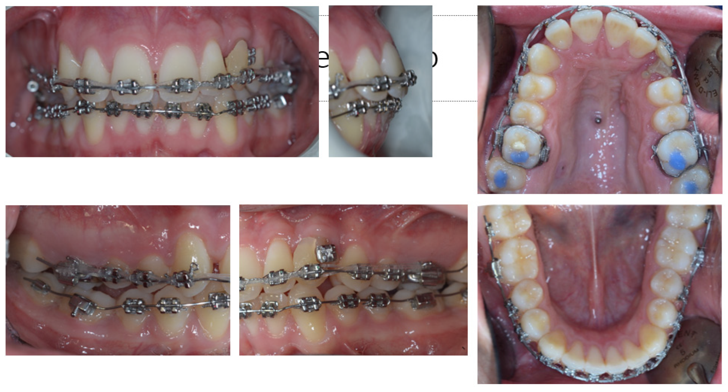 Dentistry 11 00278 g012