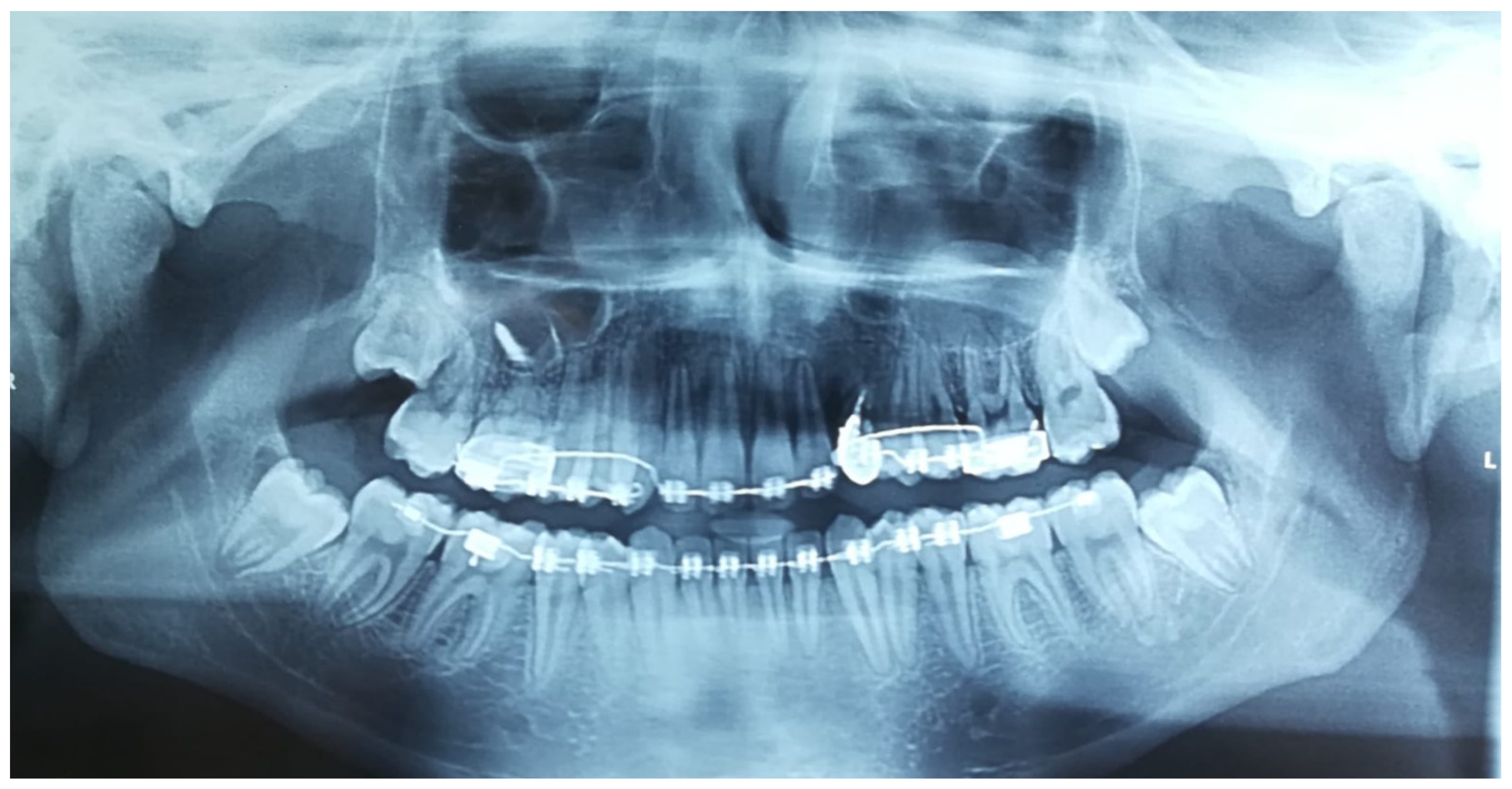 Dentistry 11 00278 g015