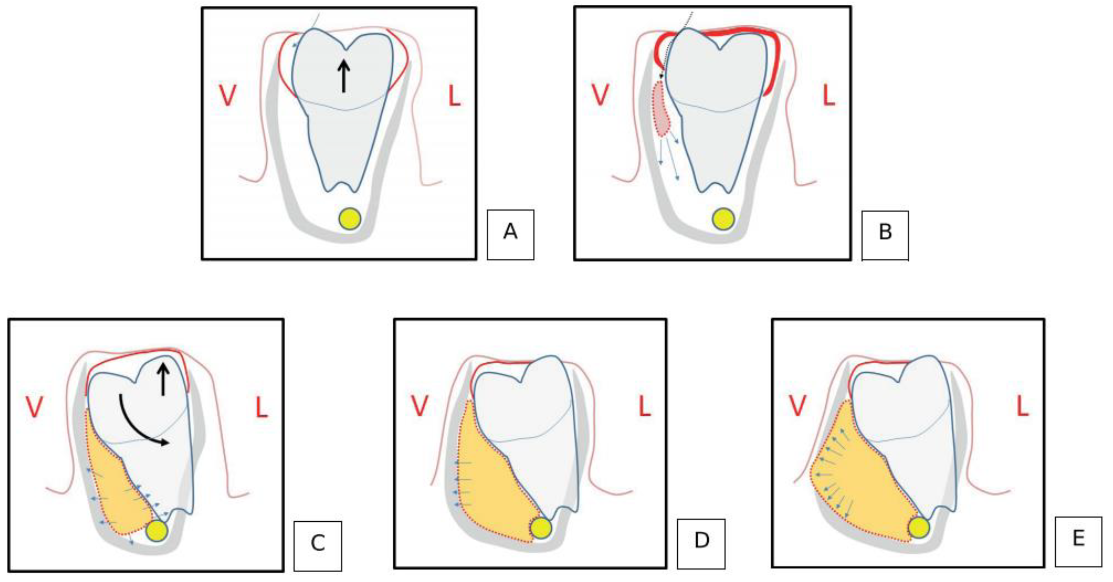 Dentistry 11 00281 g004