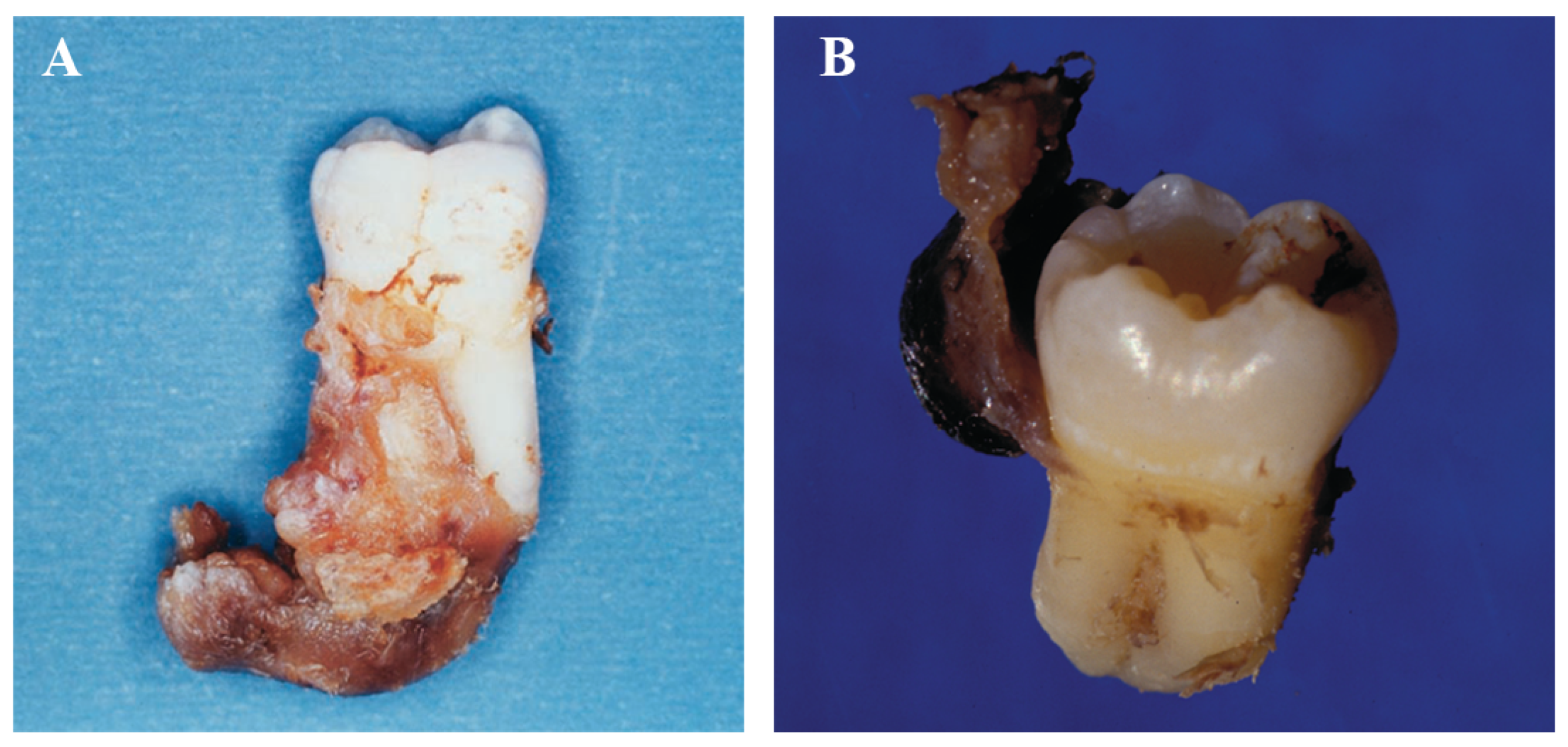 Dentistry 11 00281 g005