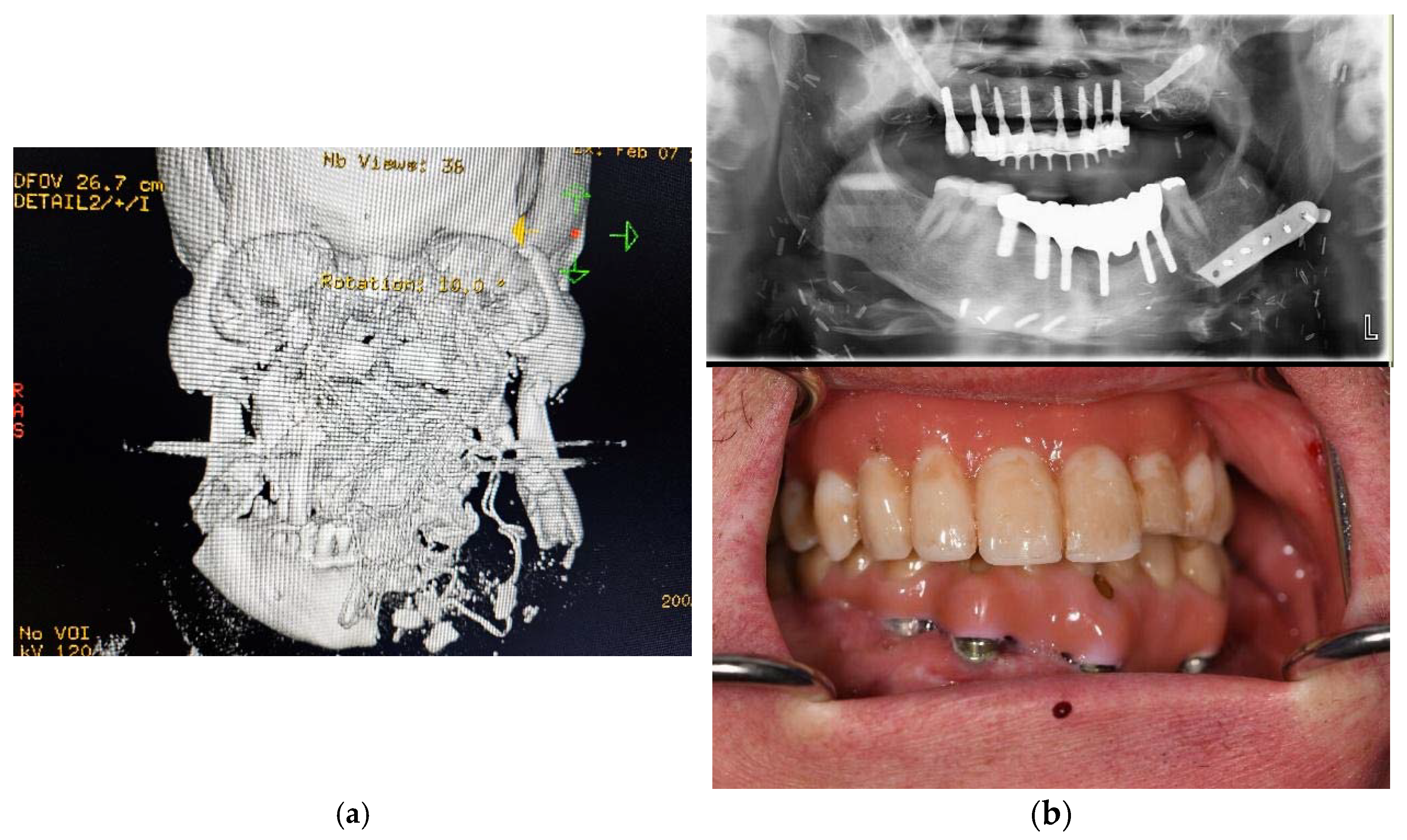Dentistry 11 00289 g002