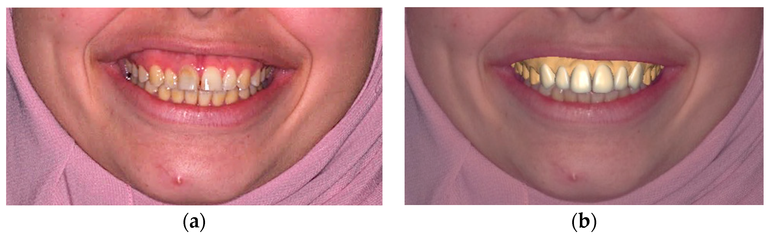 Dentistry 12 00028 g002 Dentistry 12 00028 g002