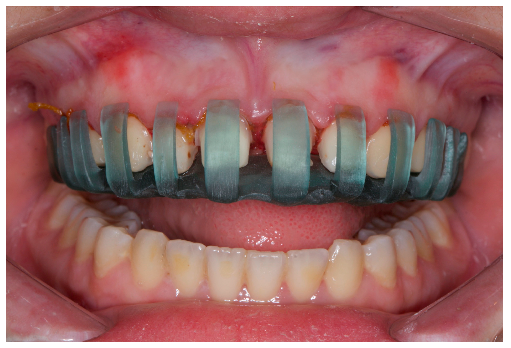 Dentistry 12 00028 g003 Dentistry 12 00028 g003