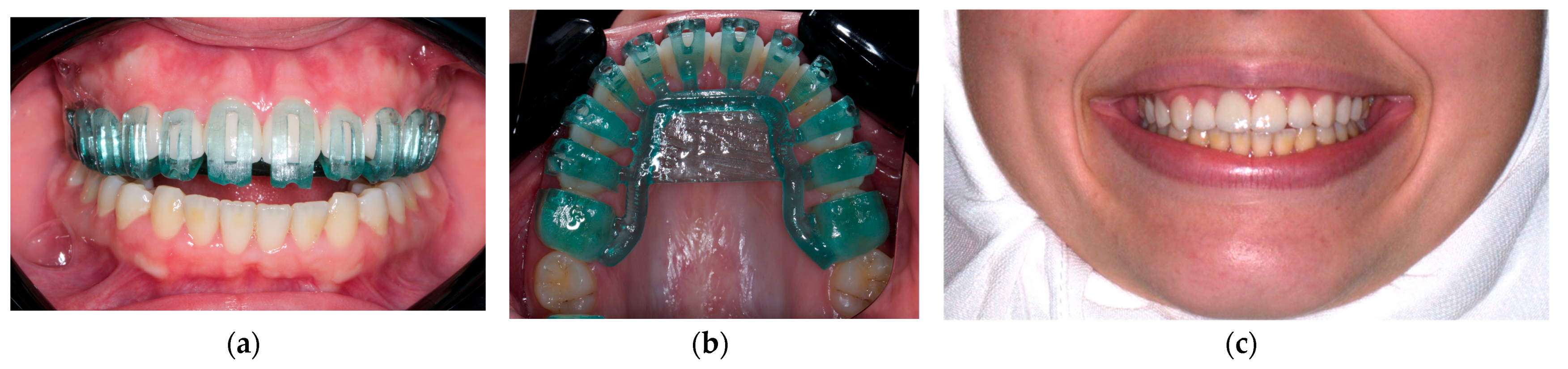 Dentistry 12 00028 g004 Dentistry 12 00028 g004