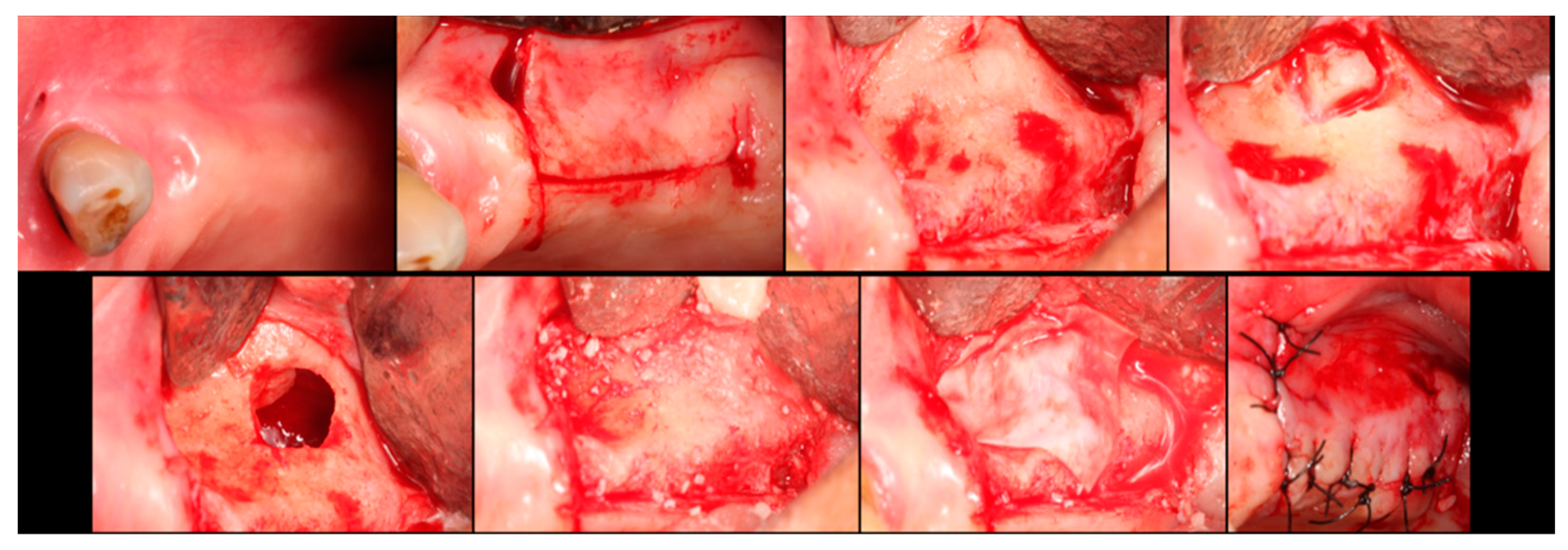 Dentistry 12 00033 g003