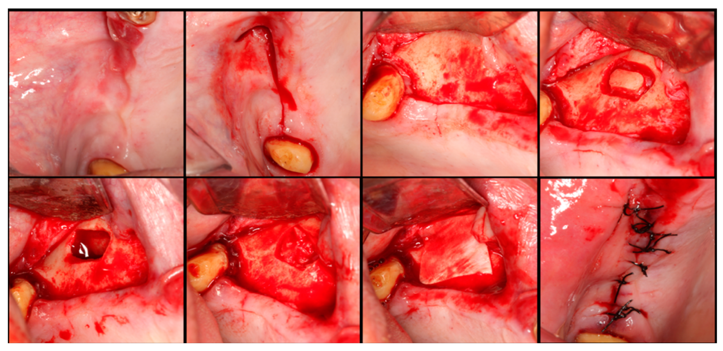 Dentistry 12 00033 g004