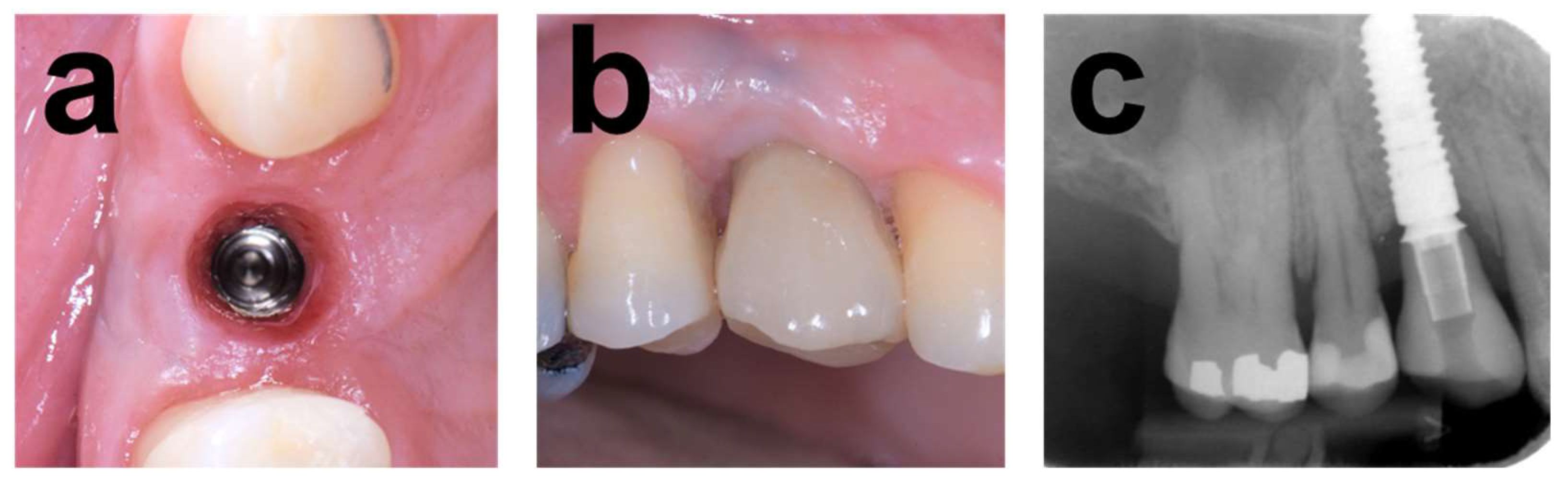 Dentistry 12 00042 g003