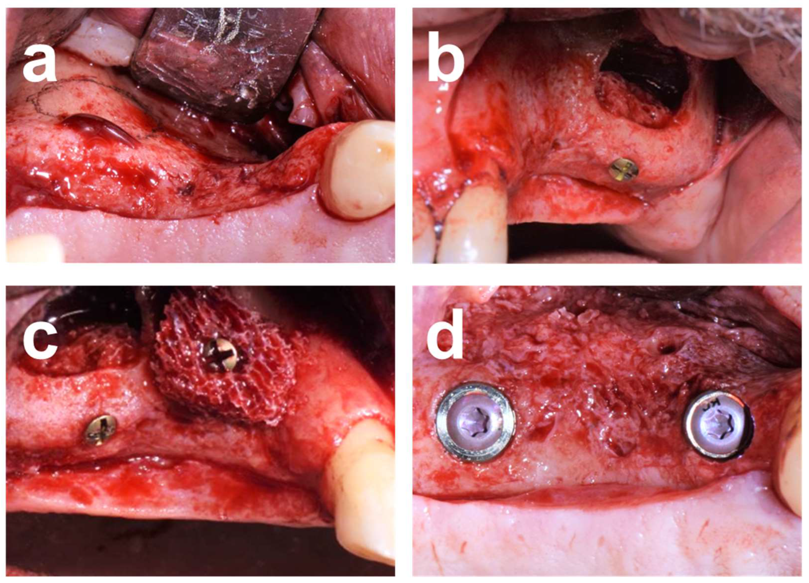 Dentistry 12 00042 g008