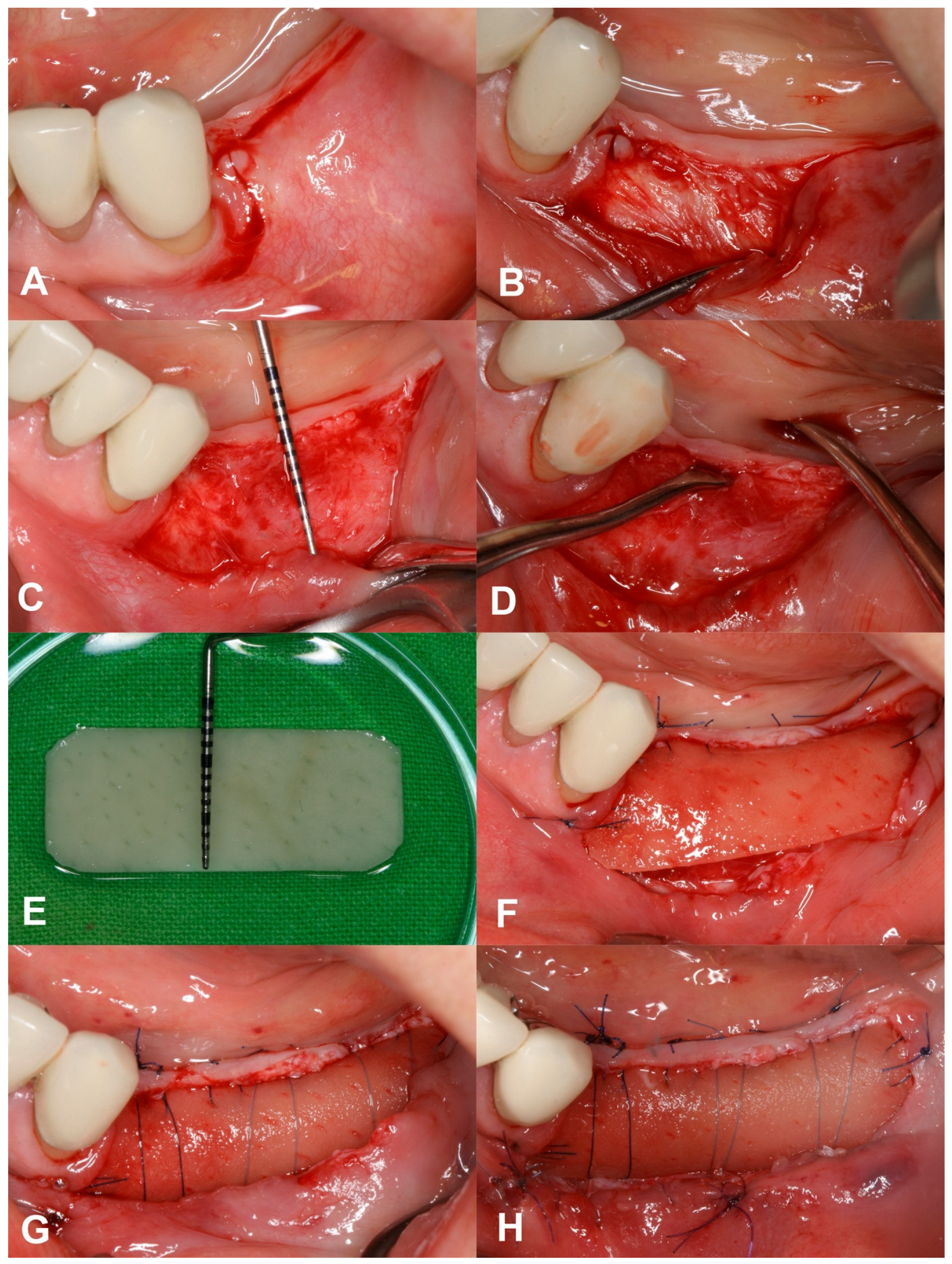 Dentistry 12 00043 g001 Dentistry 12 00043 g001
