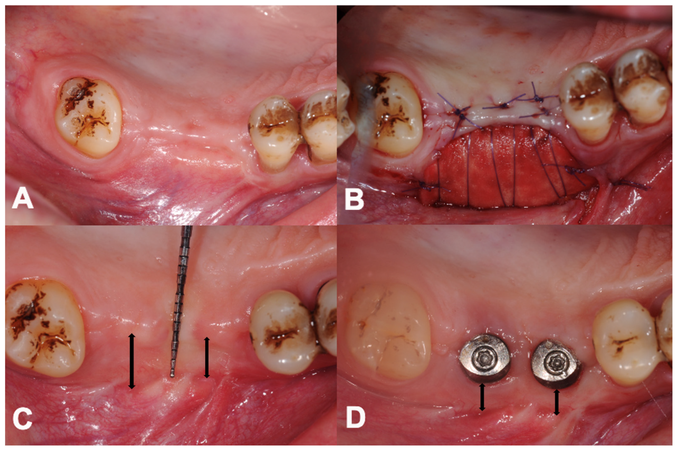 Dentistry 12 00043 g002 Dentistry 12 00043 g002