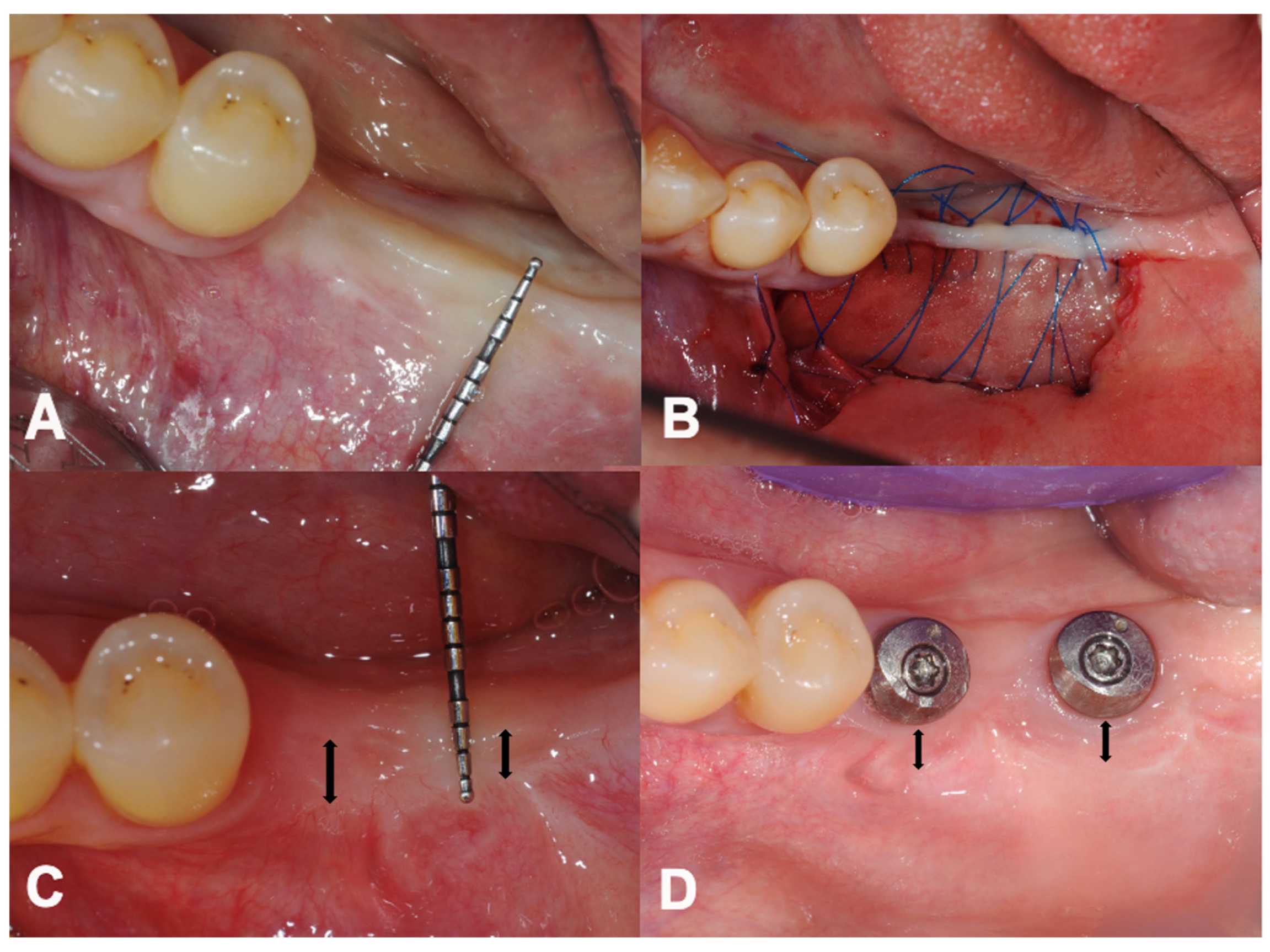 Dentistry 12 00043 g003 Dentistry 12 00043 g003