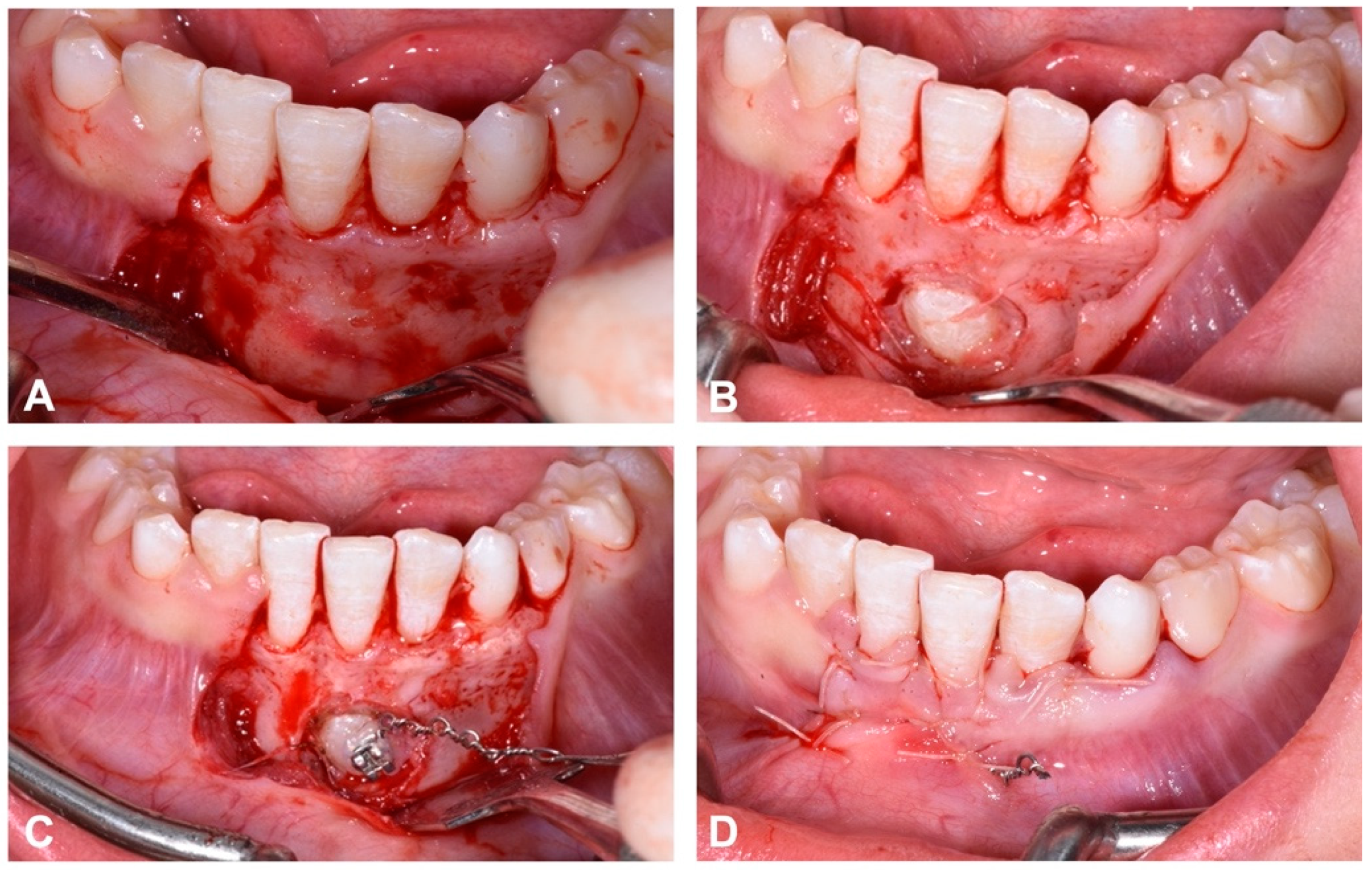 Dentistry 12 00079 g008