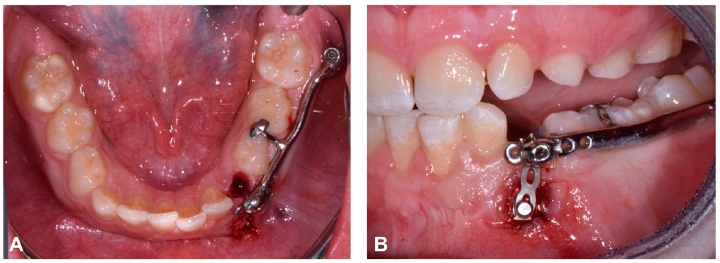 Dentistry 12 00079 g011