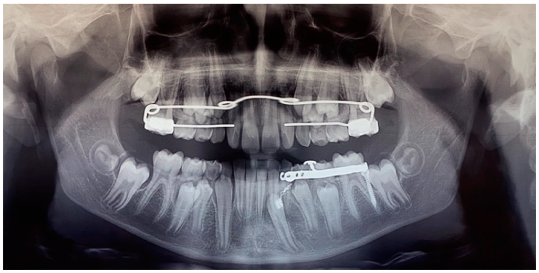 Dentistry 12 00079 g012