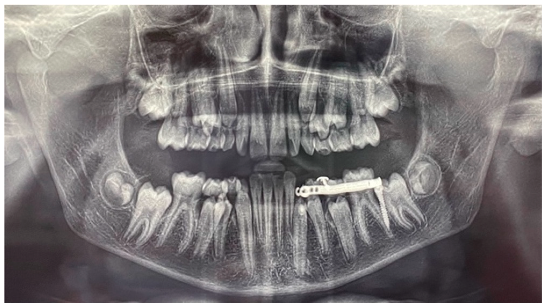 Dentistry 12 00079 g013