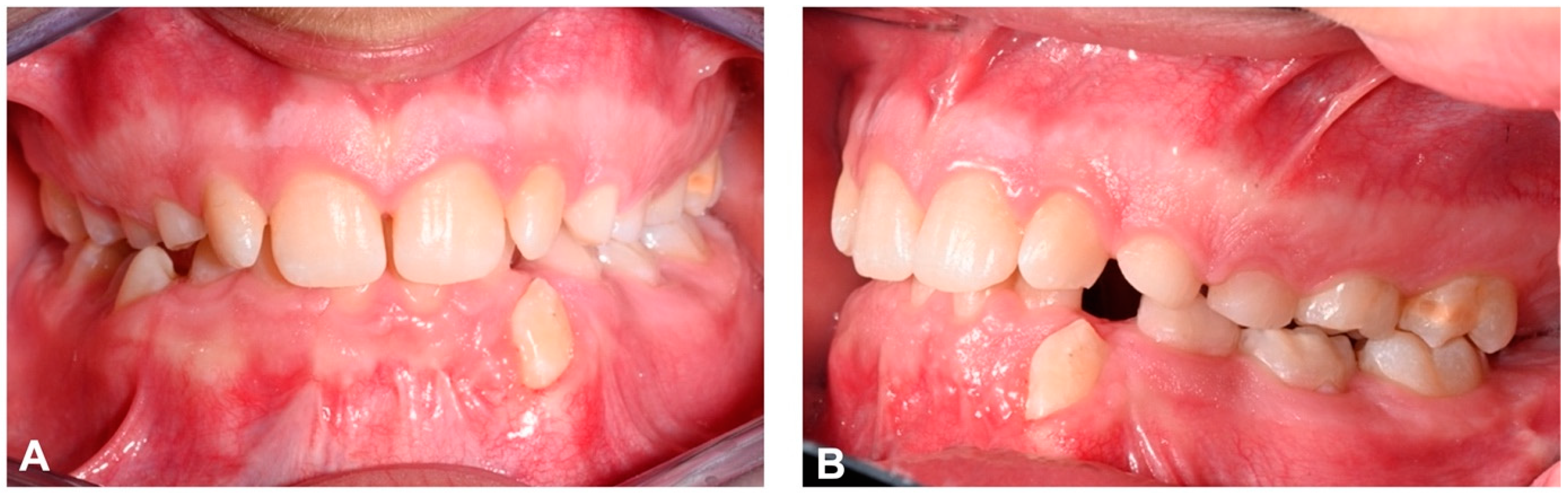 Dentistry 12 00079 g014