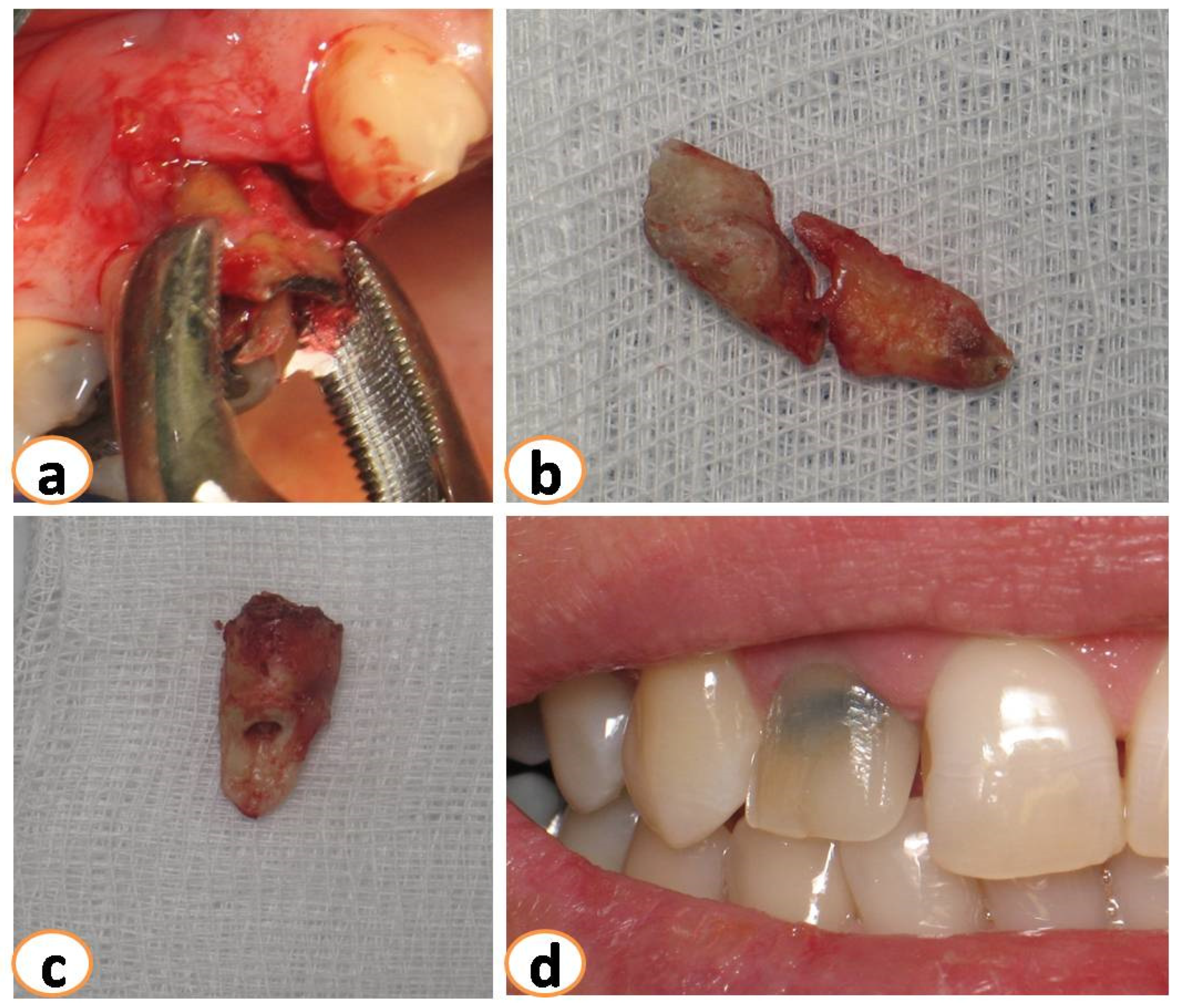 Dentistry 12 00080 g001