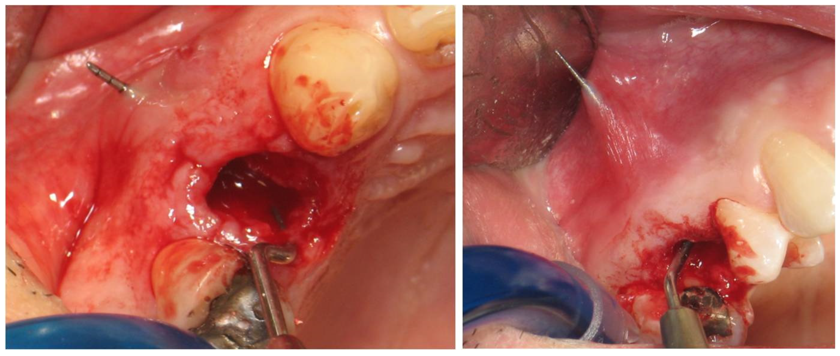 Dentistry 12 00080 g002