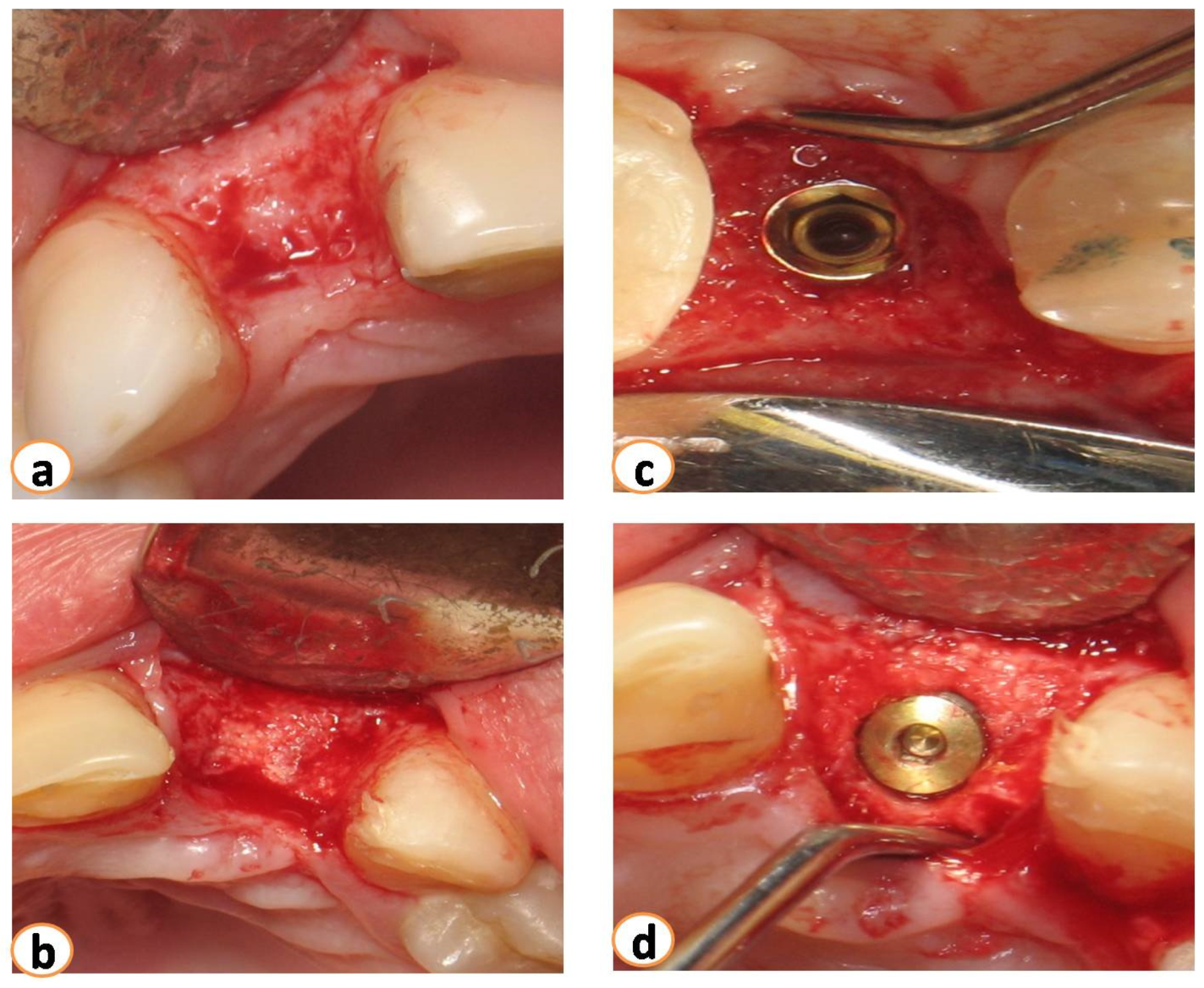 Dentistry 12 00080 g004