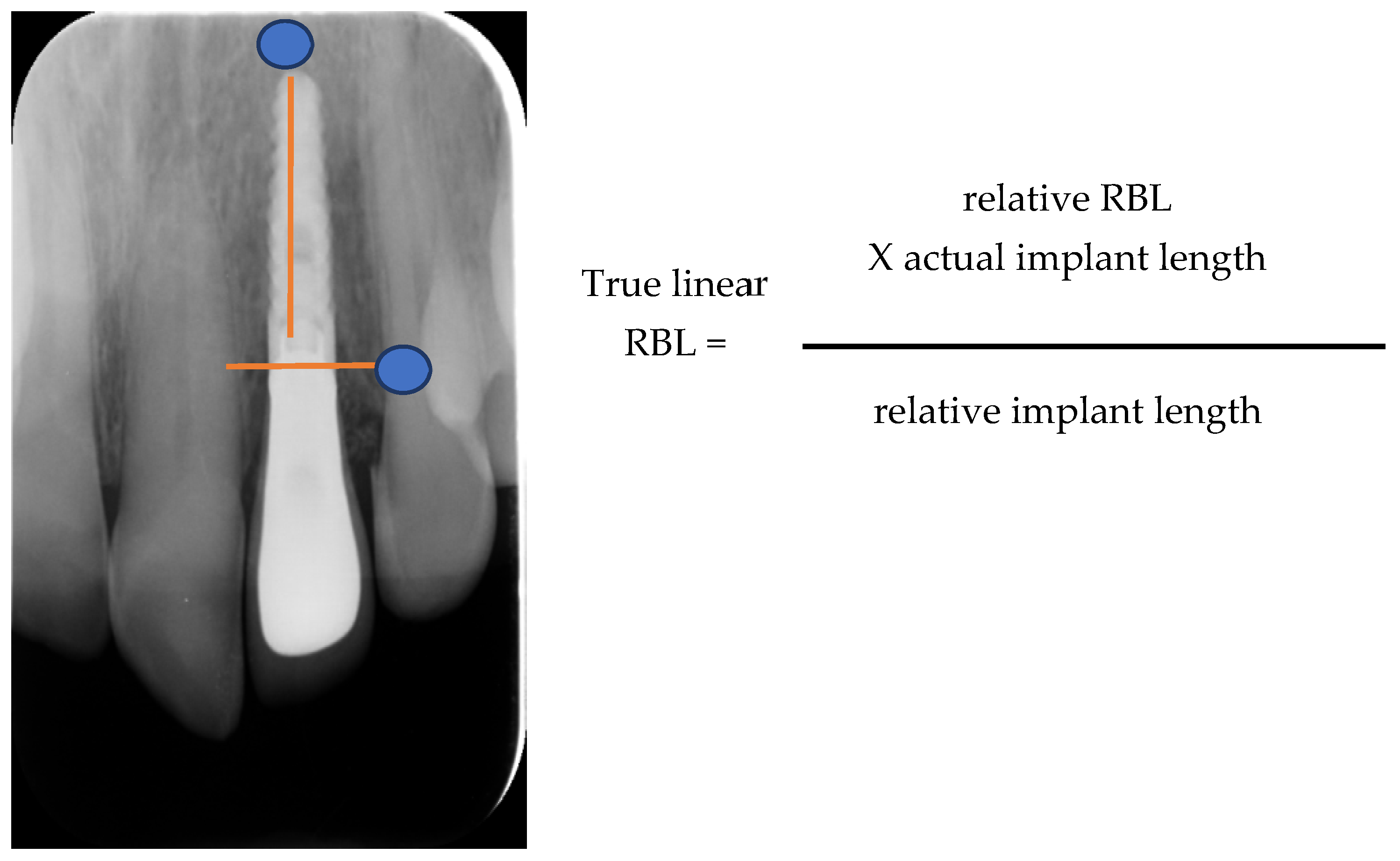 Dentistry 12 00080 g006