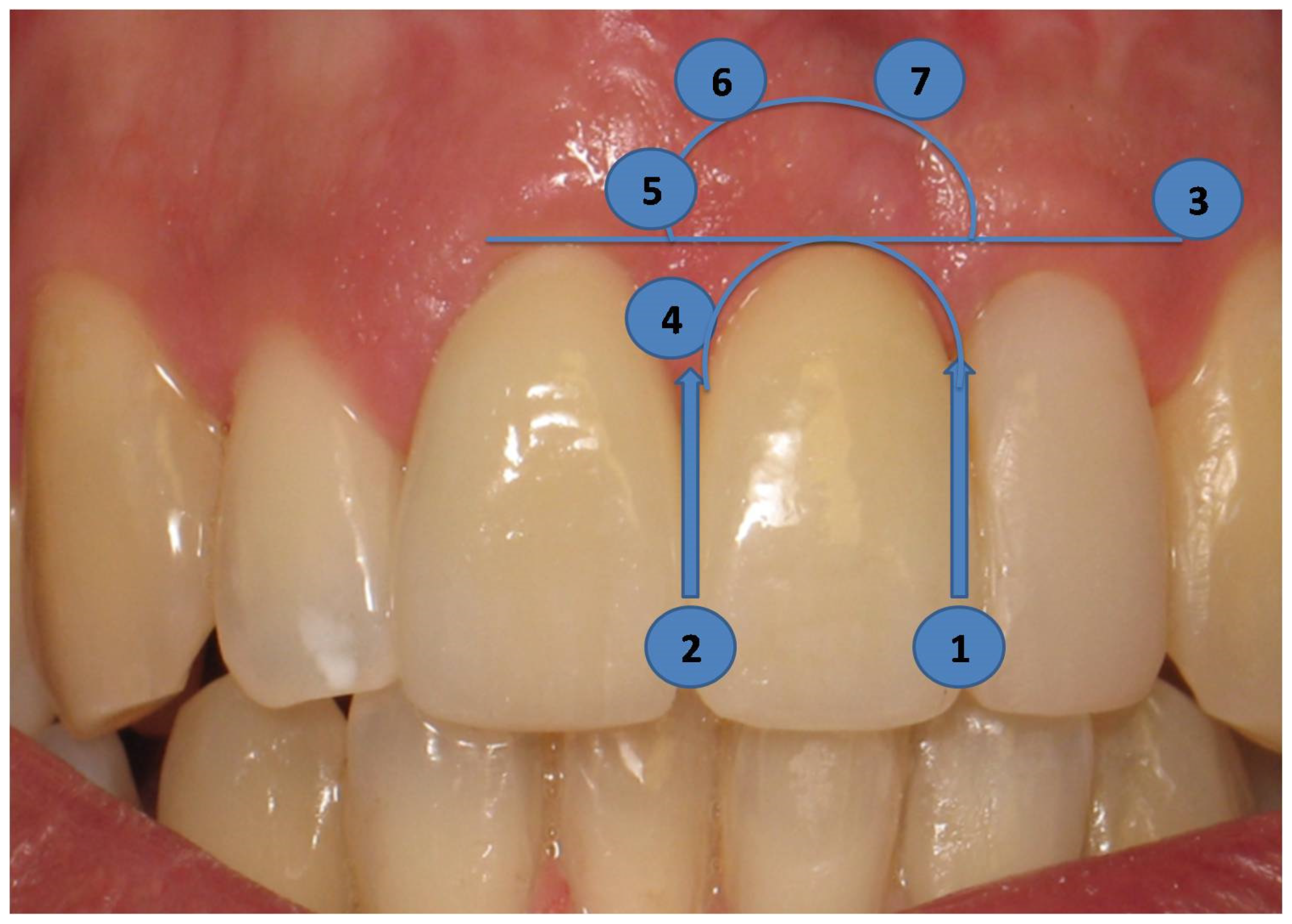 Dentistry 12 00080 g007