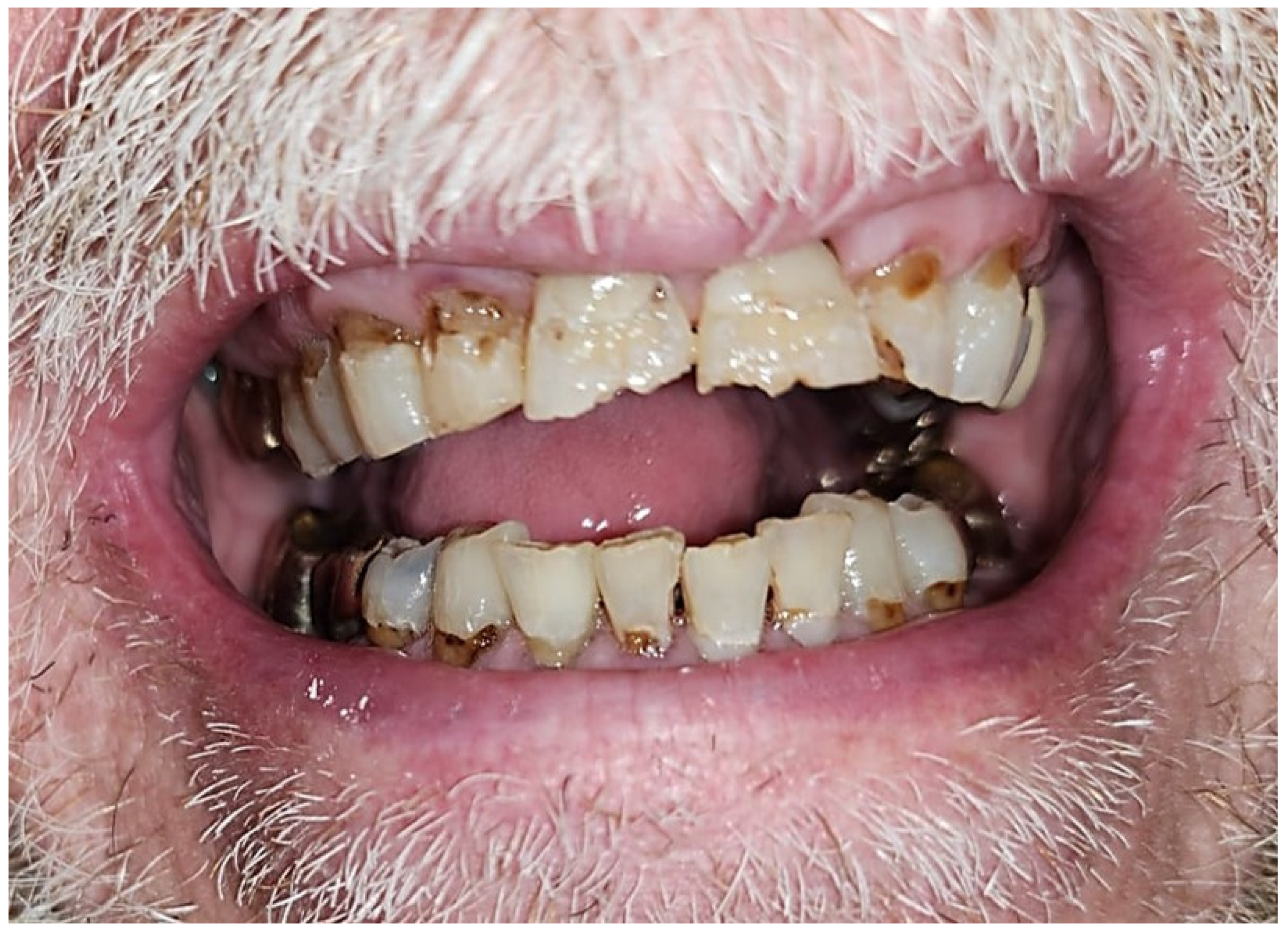 Dentistry 12 00083 g001