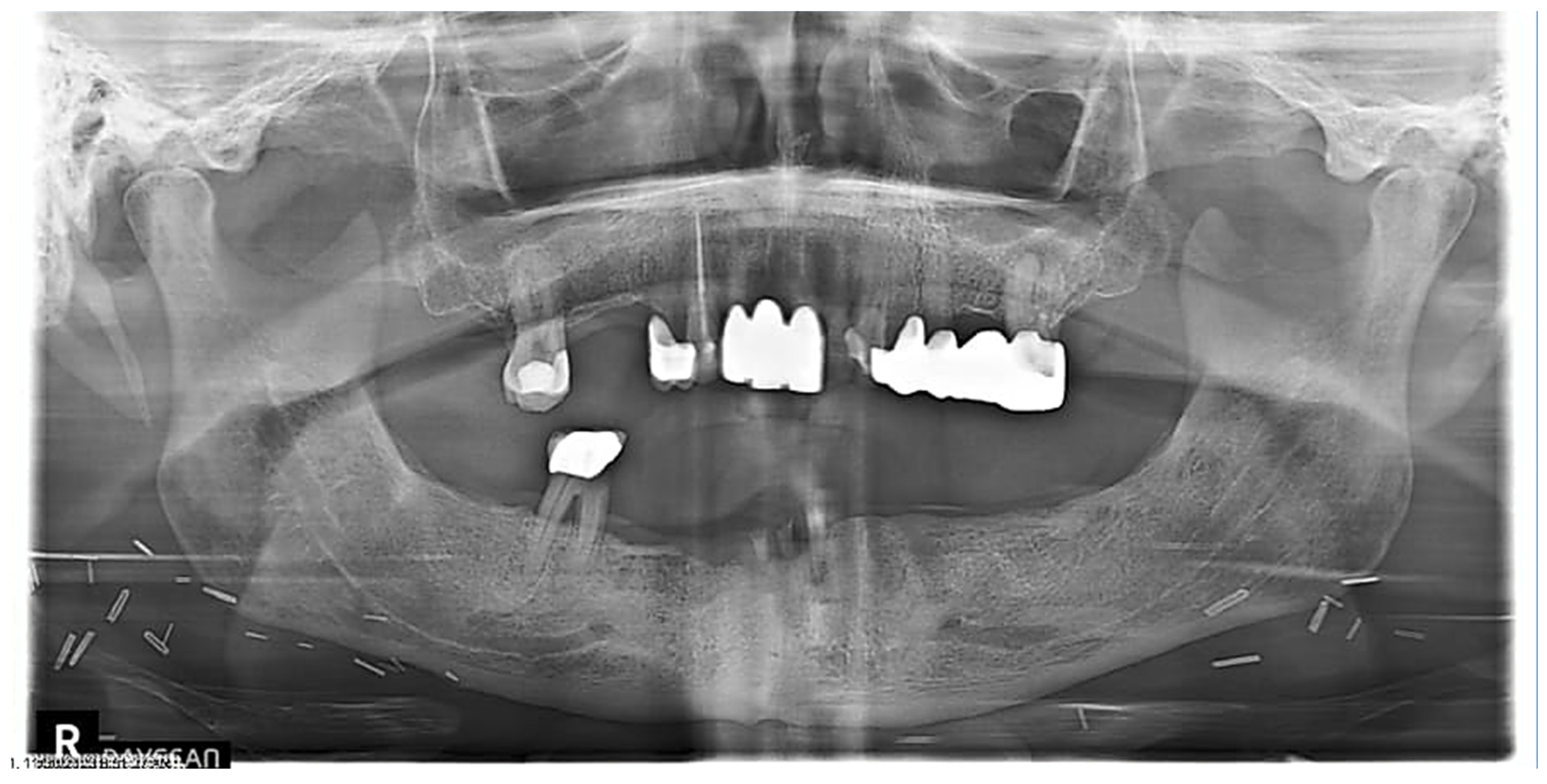 Dentistry 12 00083 g004