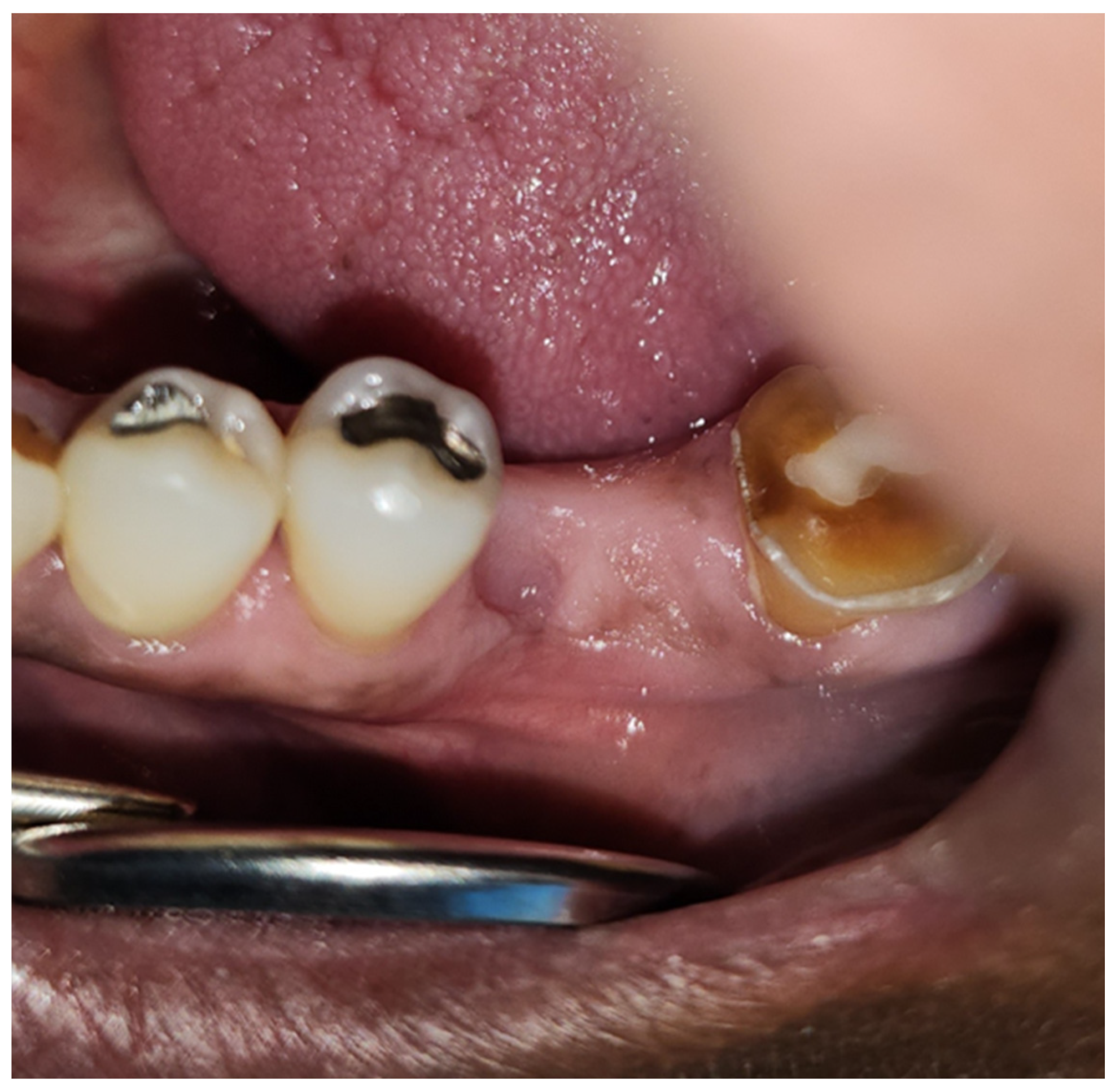 Dentistry 12 00083 g007