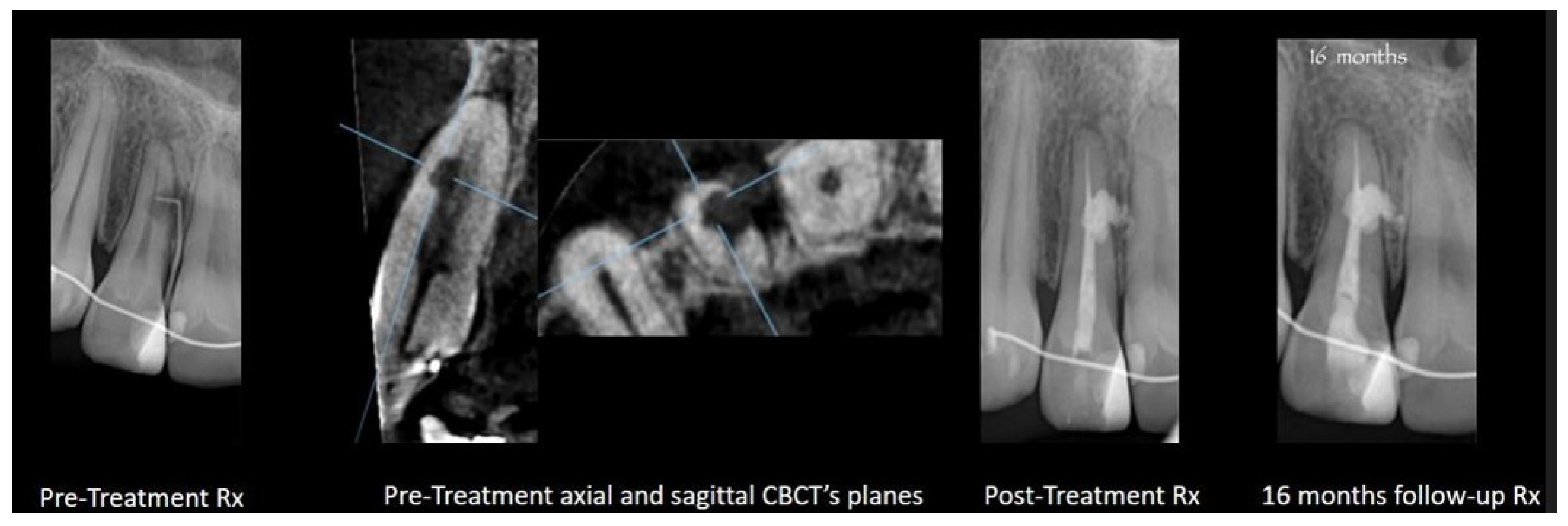 Dentistry 12 00085 g004