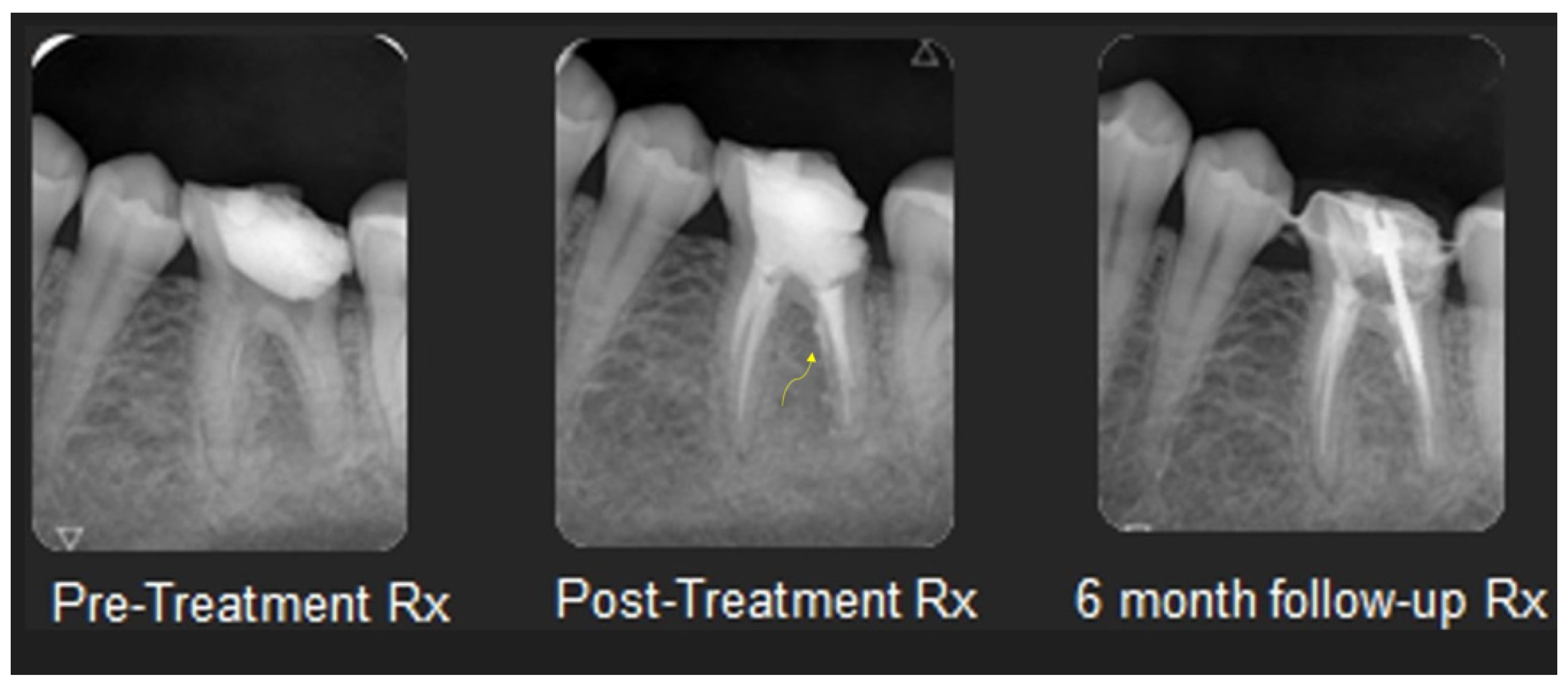 Dentistry 12 00085 g006