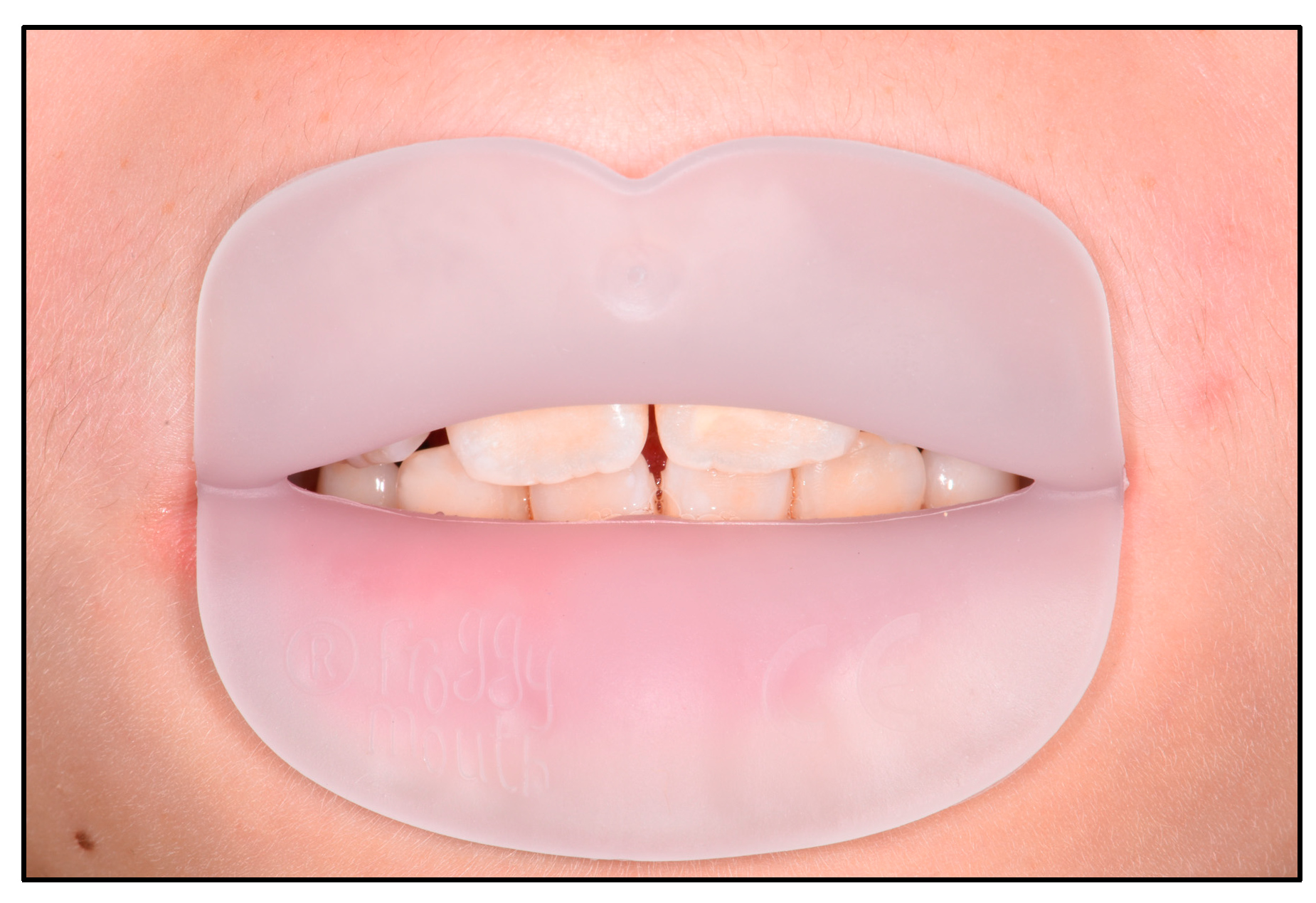 Dentistry 12 00096 g002