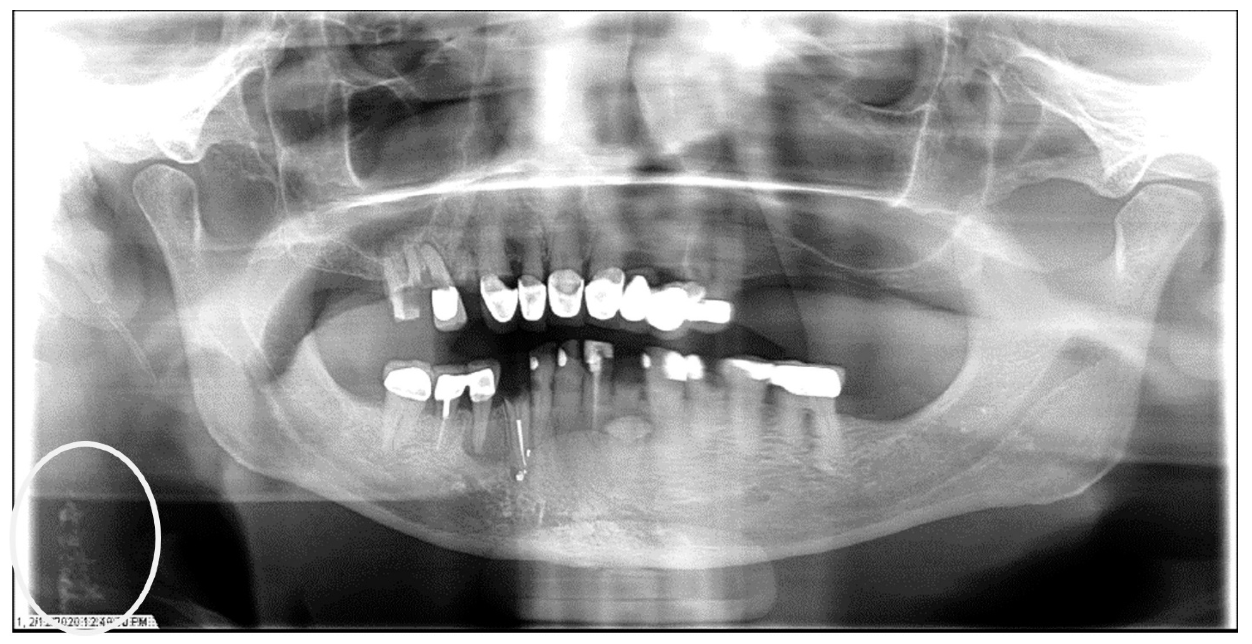 Dentistry 12 00099 g001 Dentistry 12 00099 g001