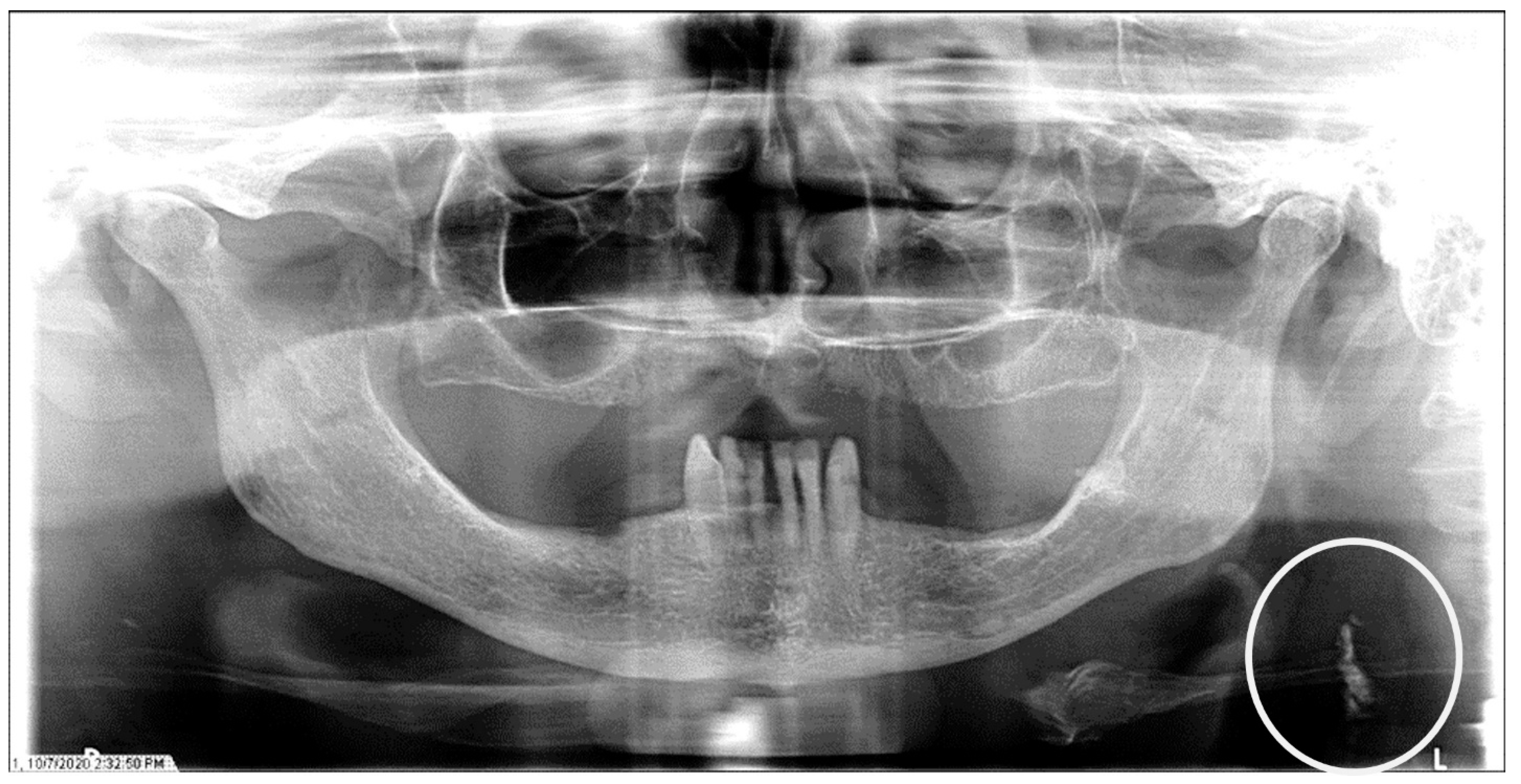 Dentistry 12 00099 g002 Dentistry 12 00099 g002