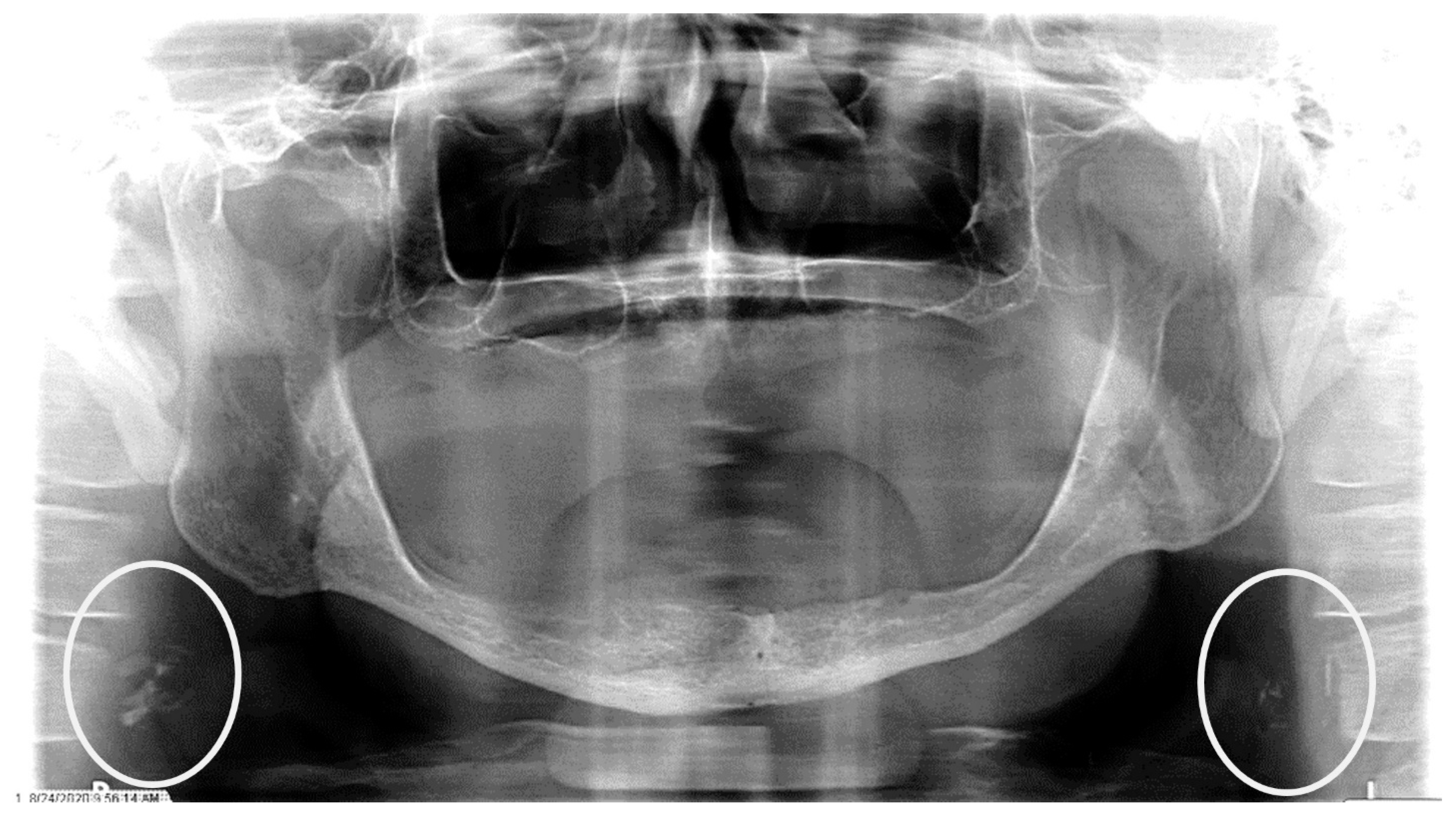 Dentistry 12 00099 g003 Dentistry 12 00099 g003