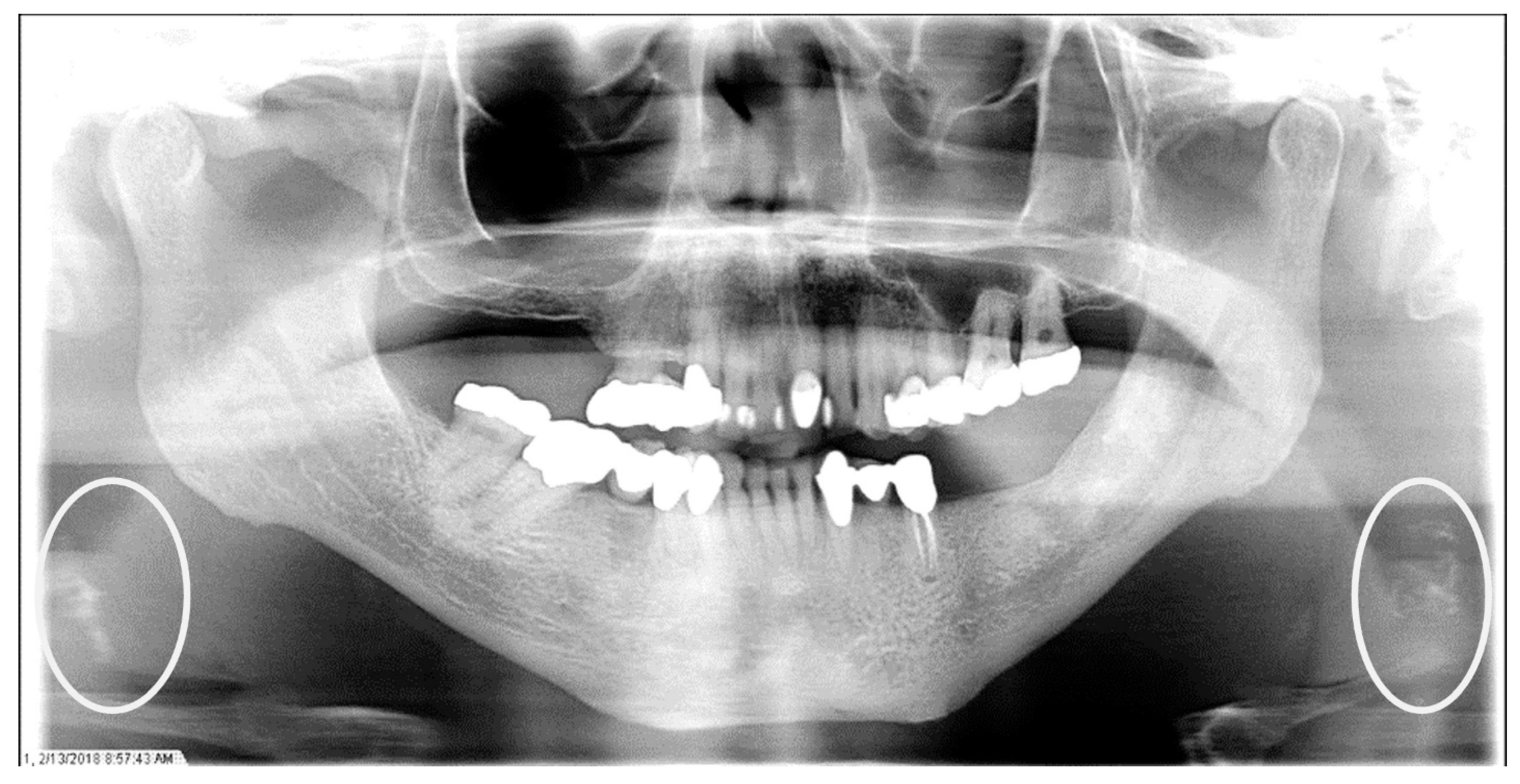 Dentistry 12 00099 g004 Dentistry 12 00099 g004