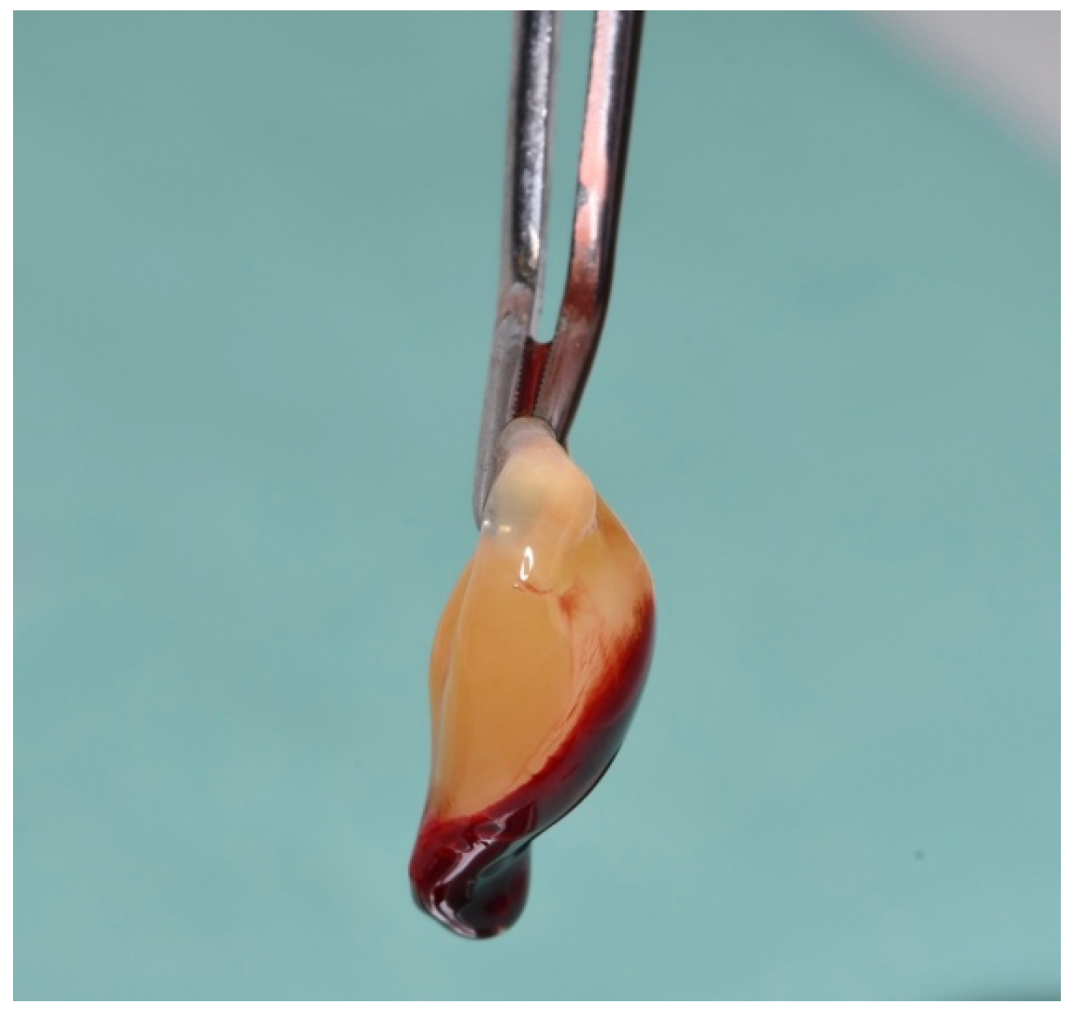 Dentistry 12 00135 g003 Dentistry 12 00135 g003