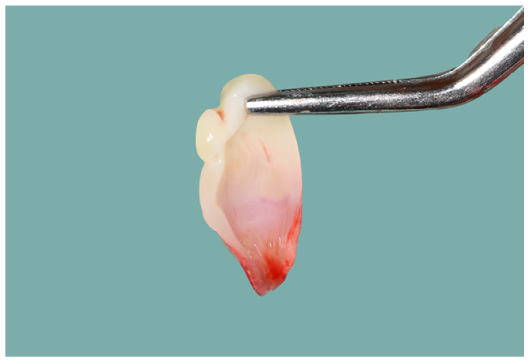 Dentistry 12 00135 g004 Dentistry 12 00135 g004