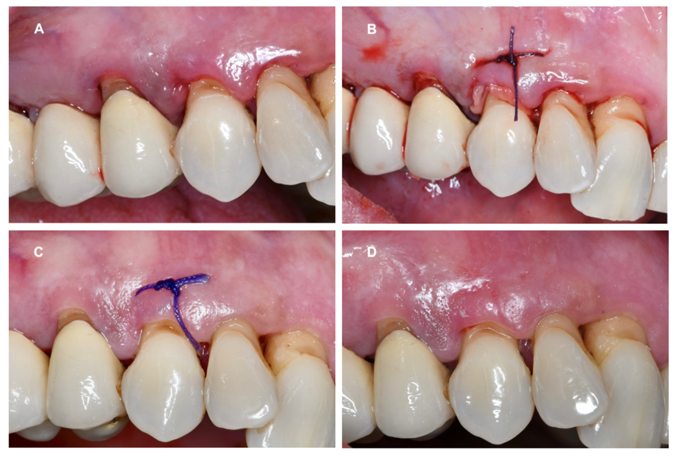 Dentistry 12 00135 g005 Dentistry 12 00135 g005