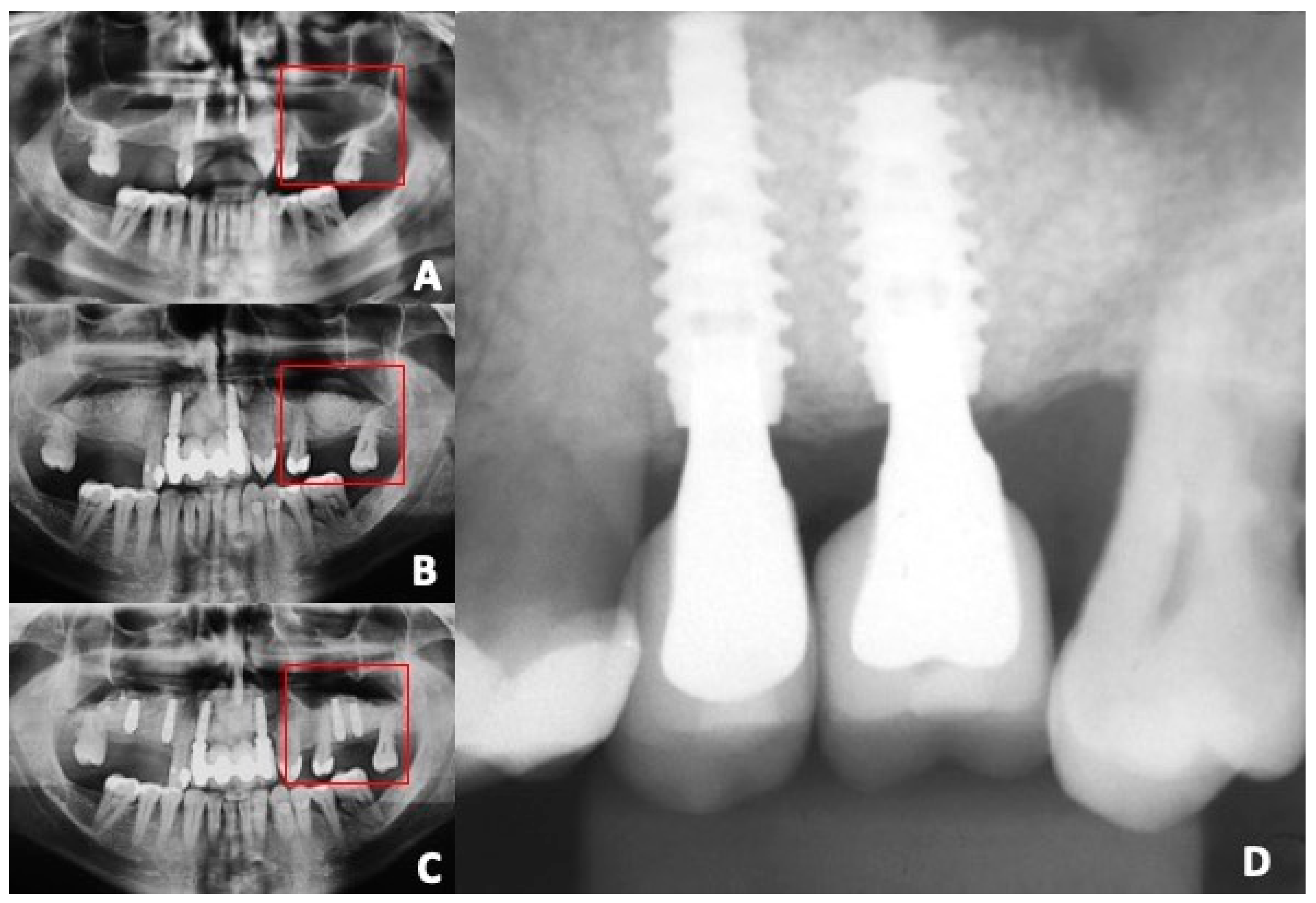 Dentistry 12 00181 g001