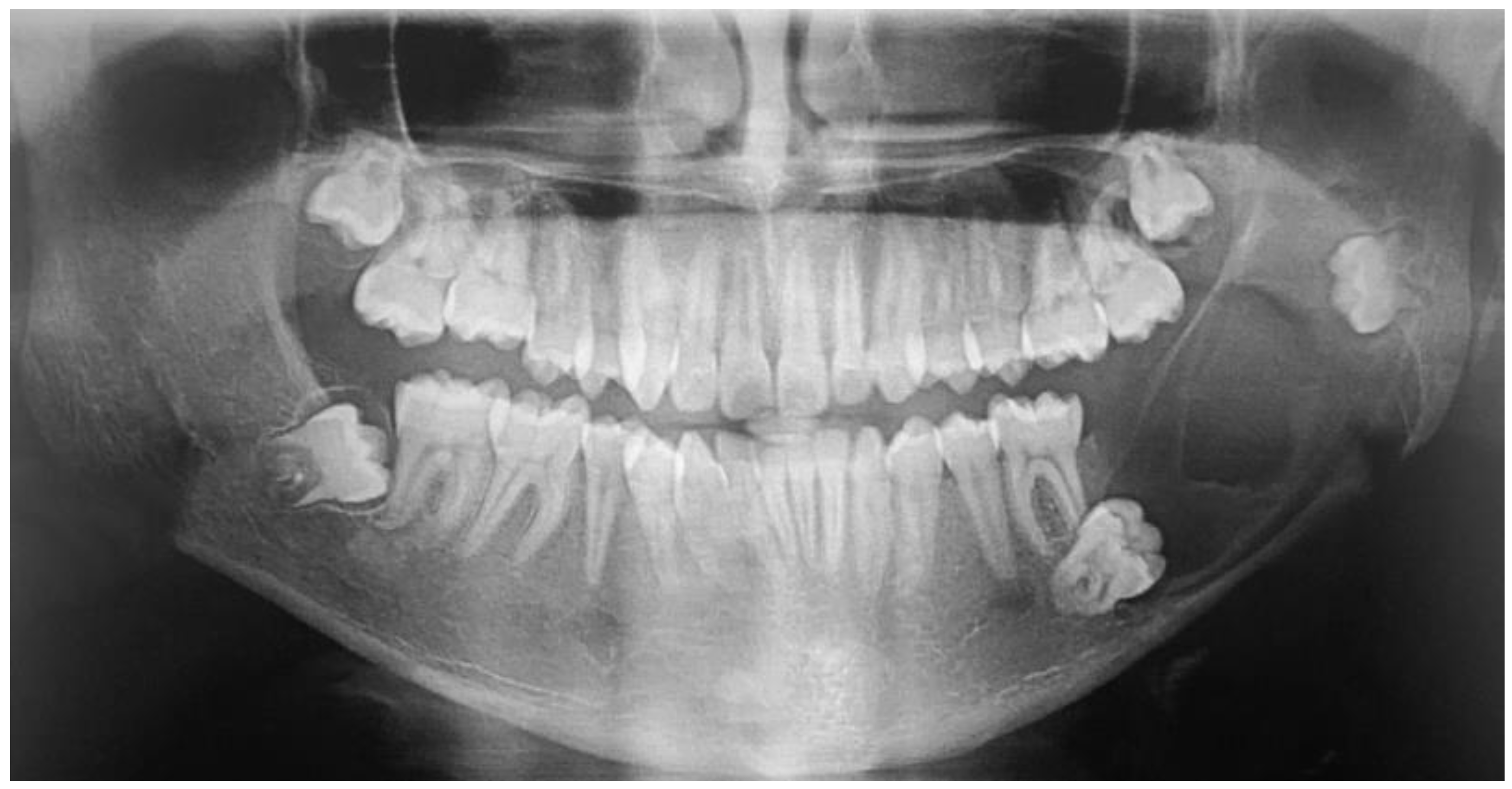 Dentistry 12 00192 g001 Dentistry 12 00192 g001