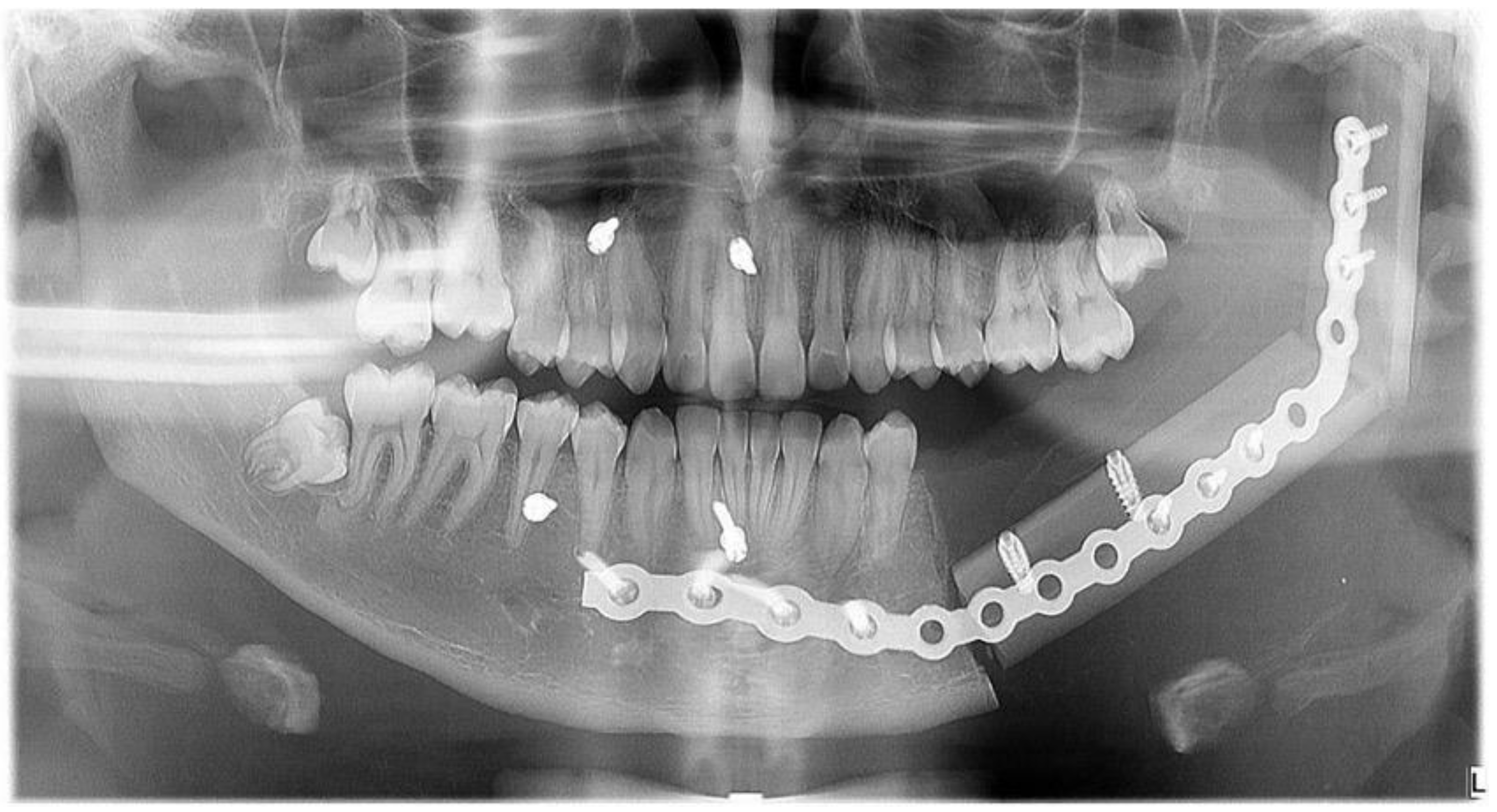 Dentistry 12 00192 g011 Dentistry 12 00192 g011