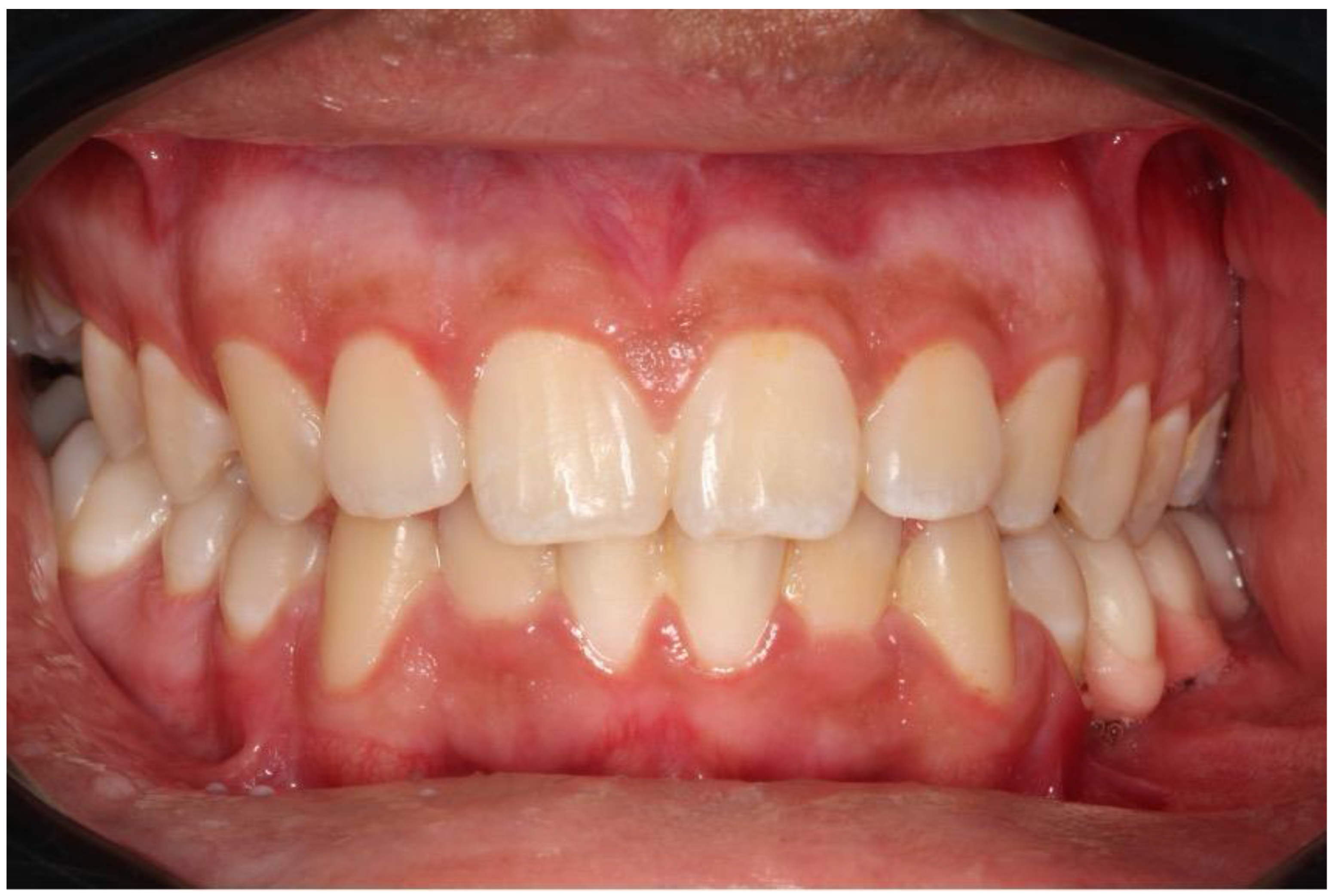 Dentistry 12 00192 g013 Dentistry 12 00192 g013