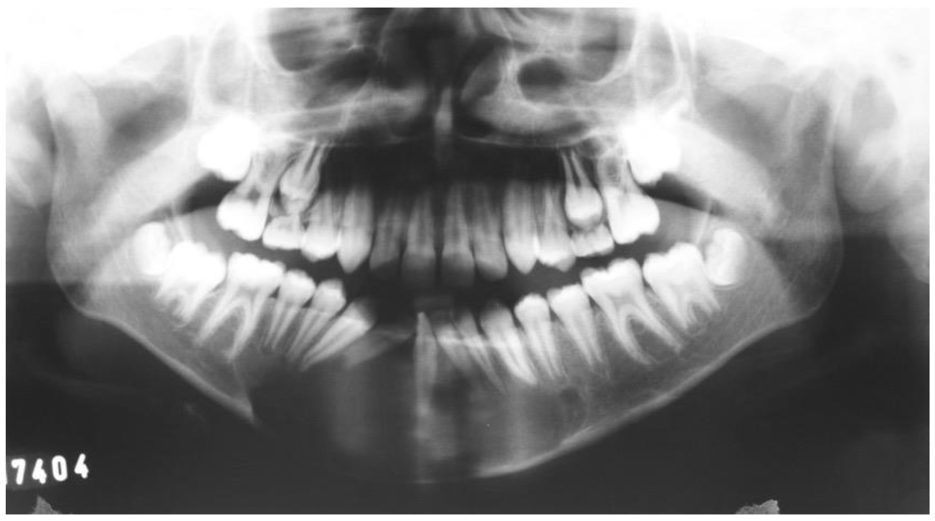 Dentistry 12 00192 g014 Dentistry 12 00192 g014