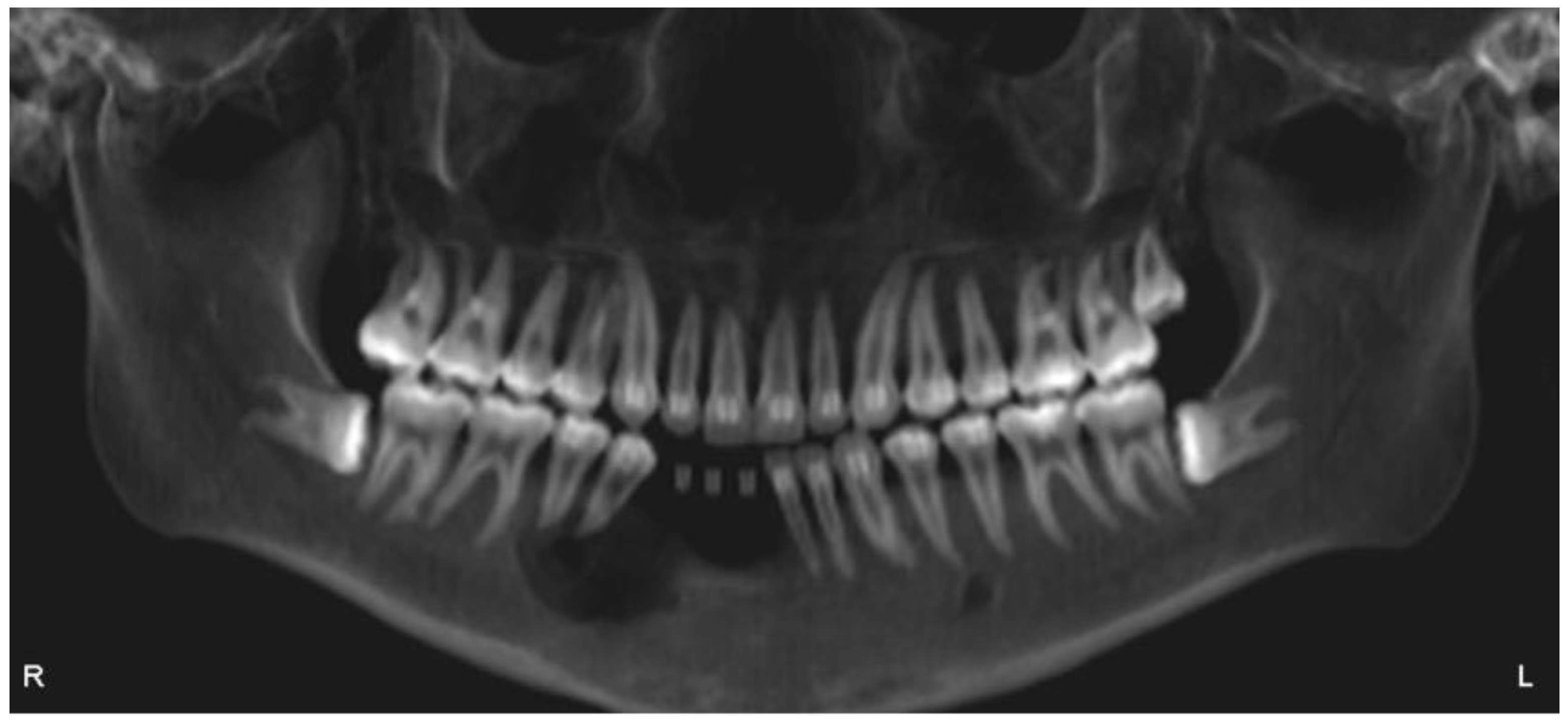 Dentistry 12 00192 g015 Dentistry 12 00192 g015